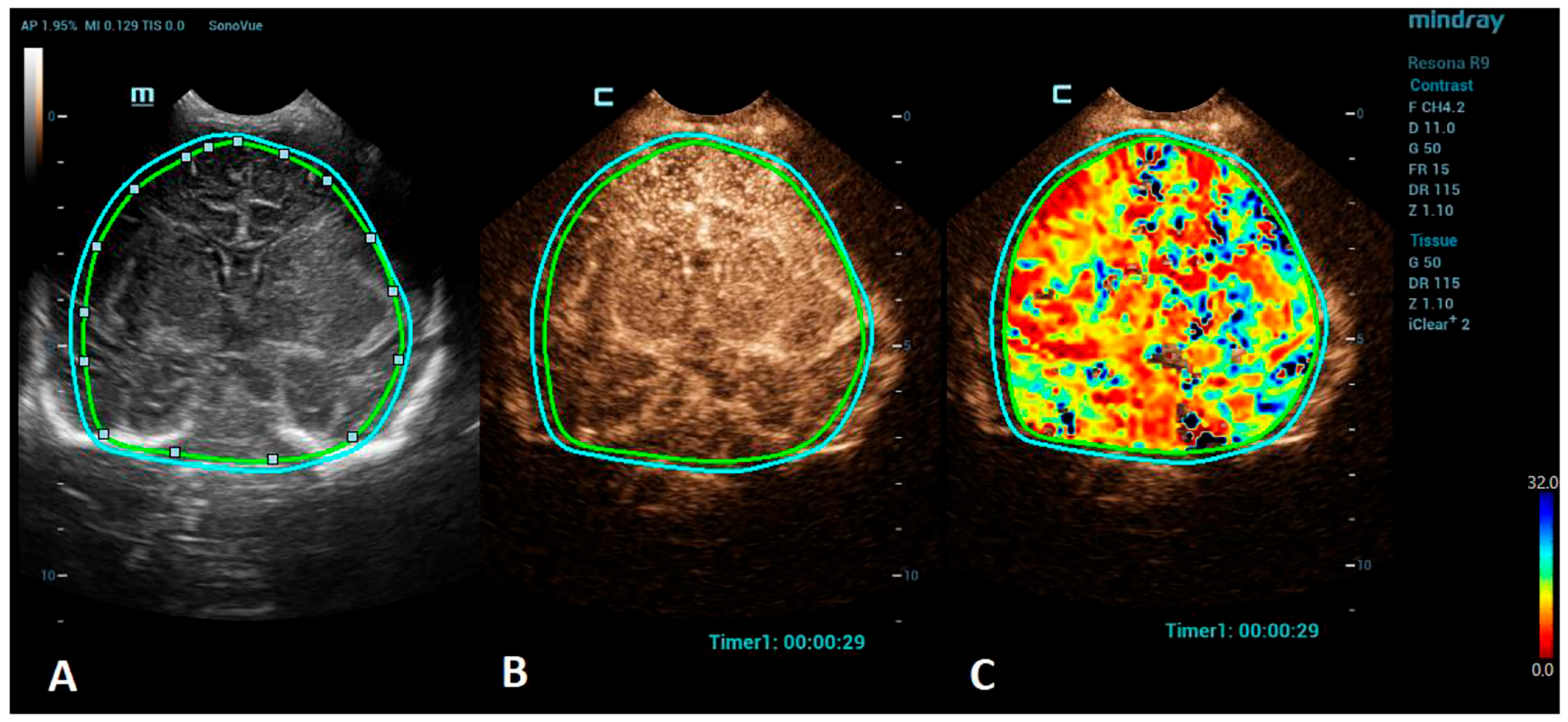 Children 10 01303 g002