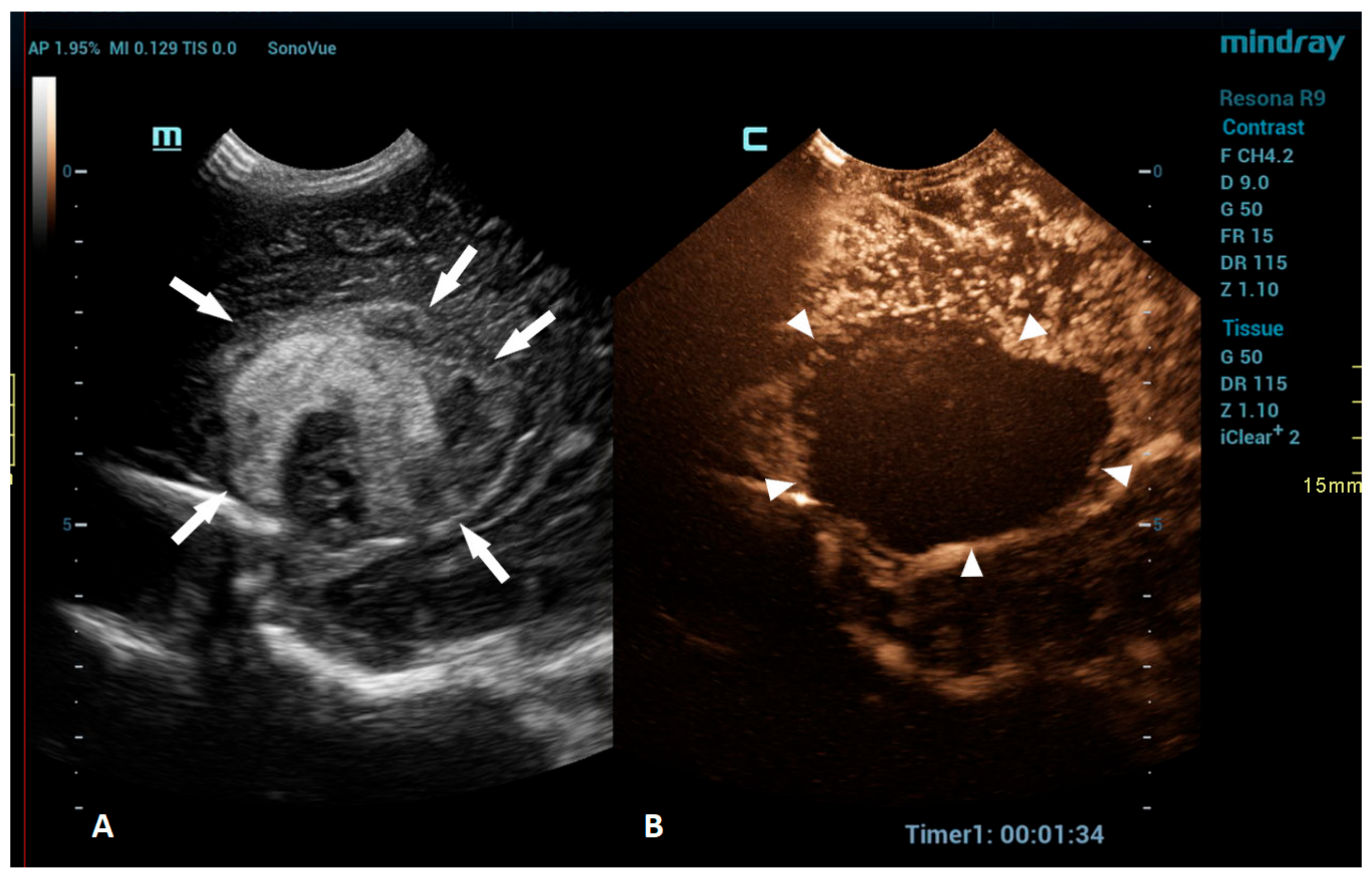 Children 10 01303 g003