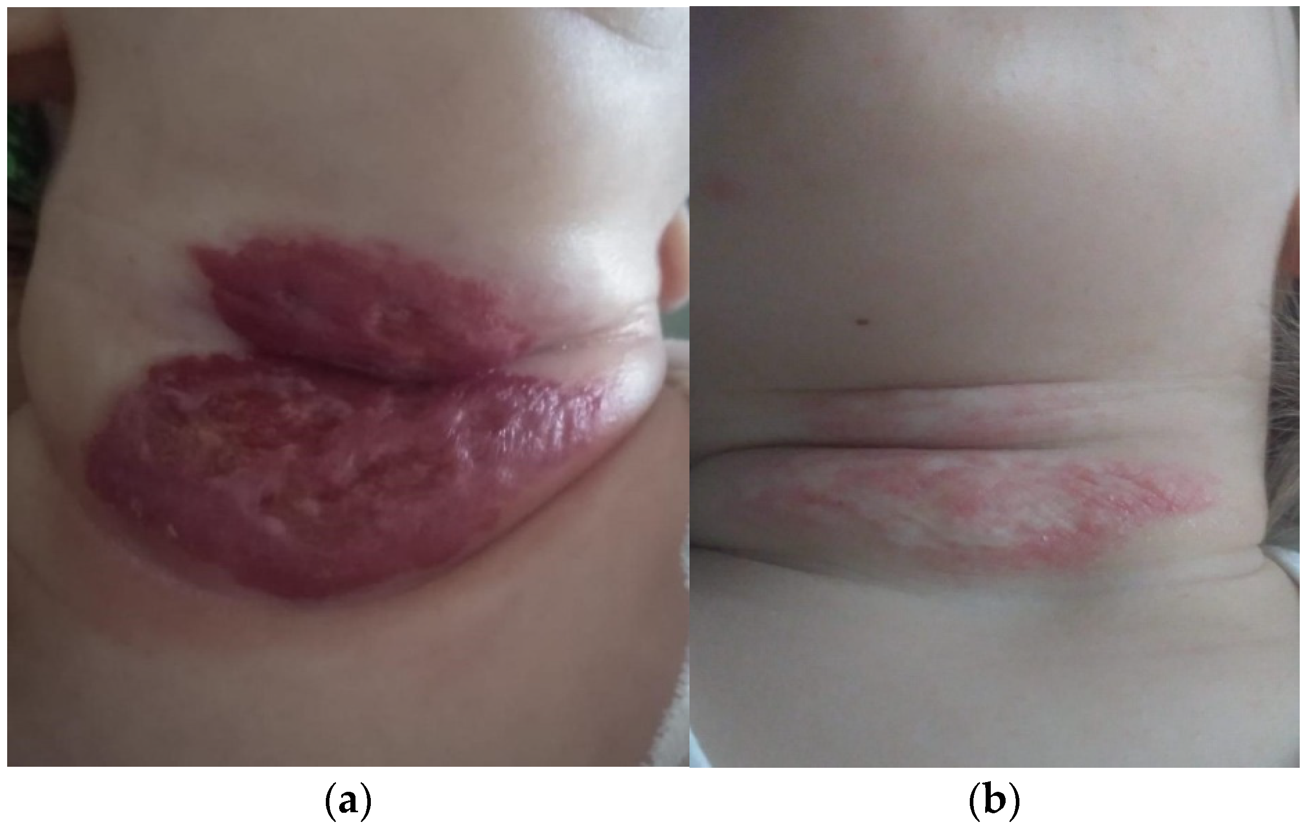 Children 10 01314 g002 Children 10 01314 g002