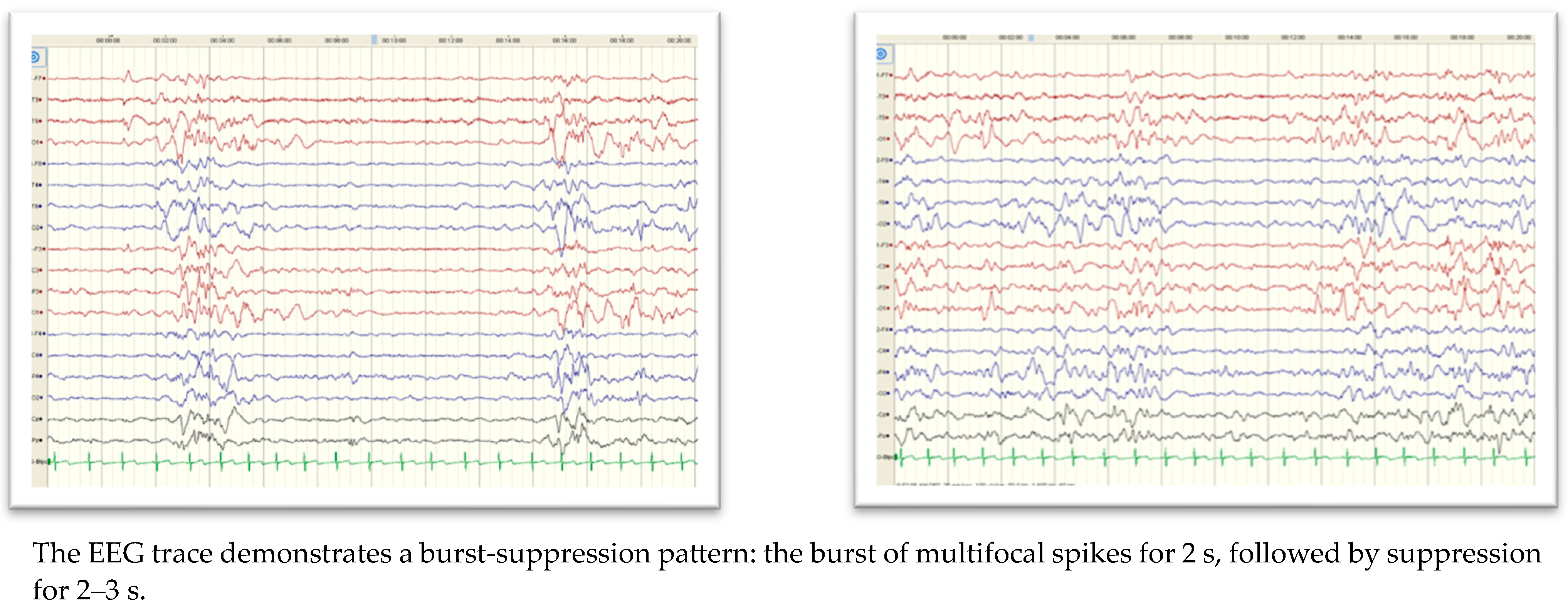 Children 10 01334 g002