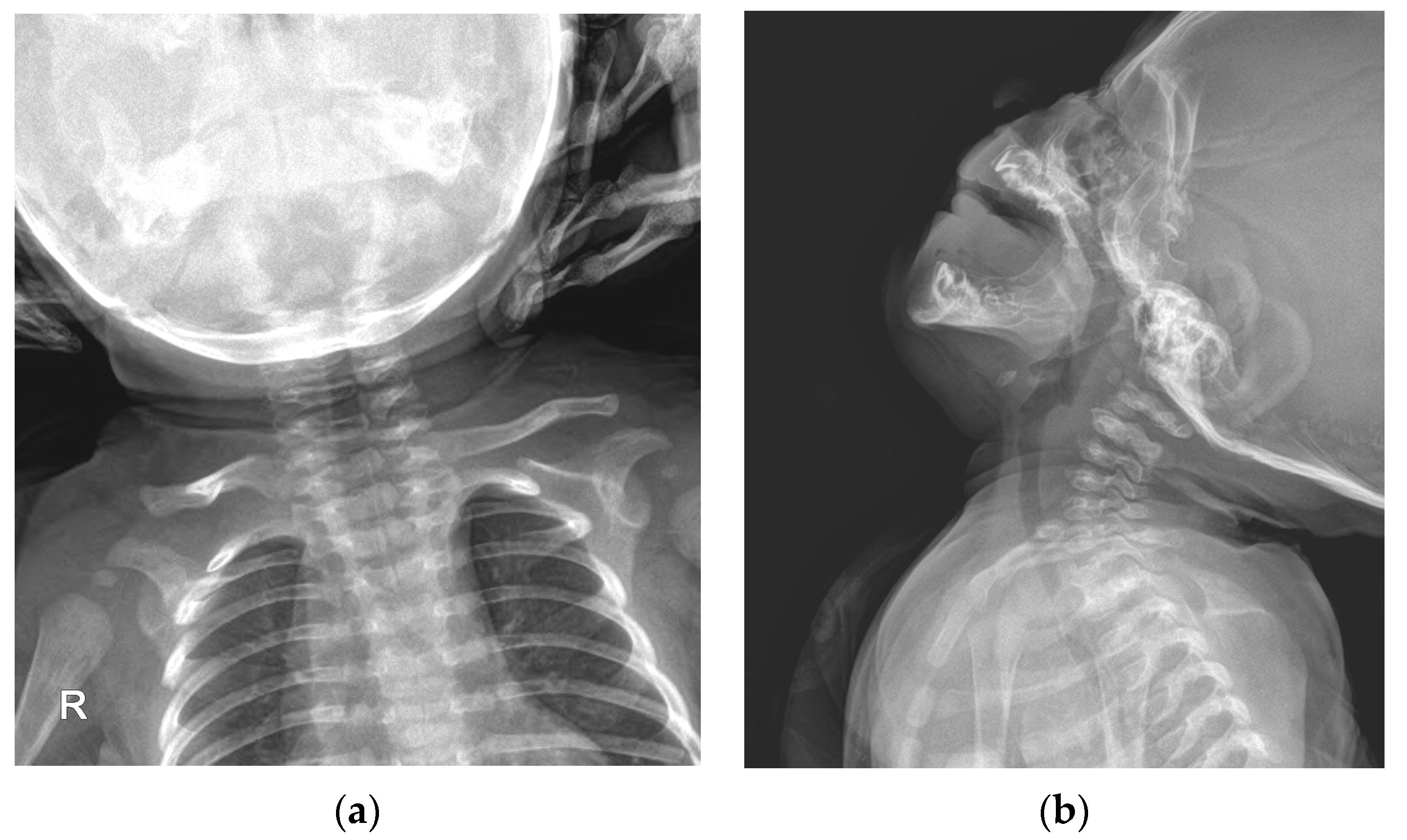 Children 10 01352 g003