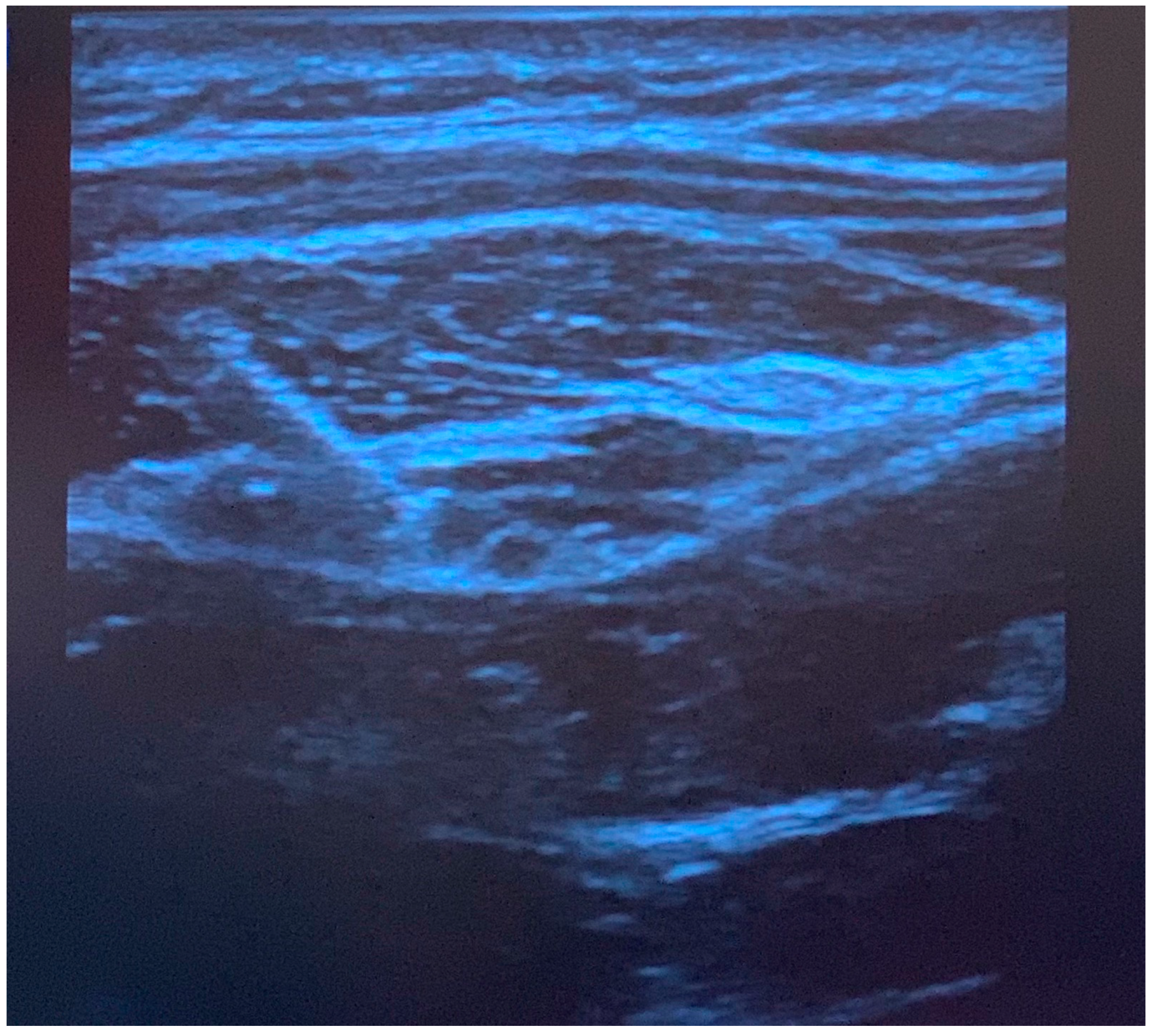 Children 10 01374 g002 Children 10 01374 g002