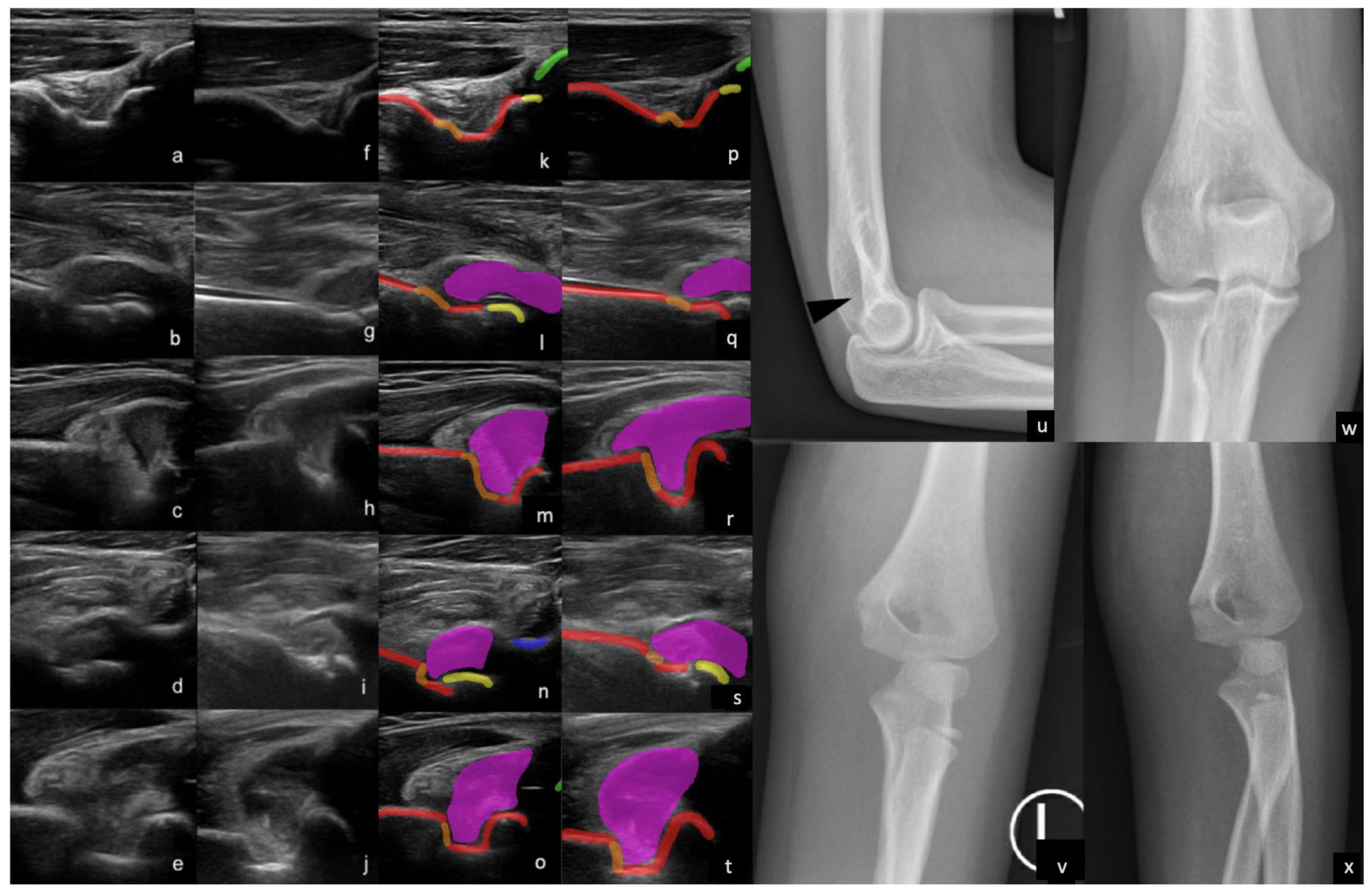 Children 10 01766 g003