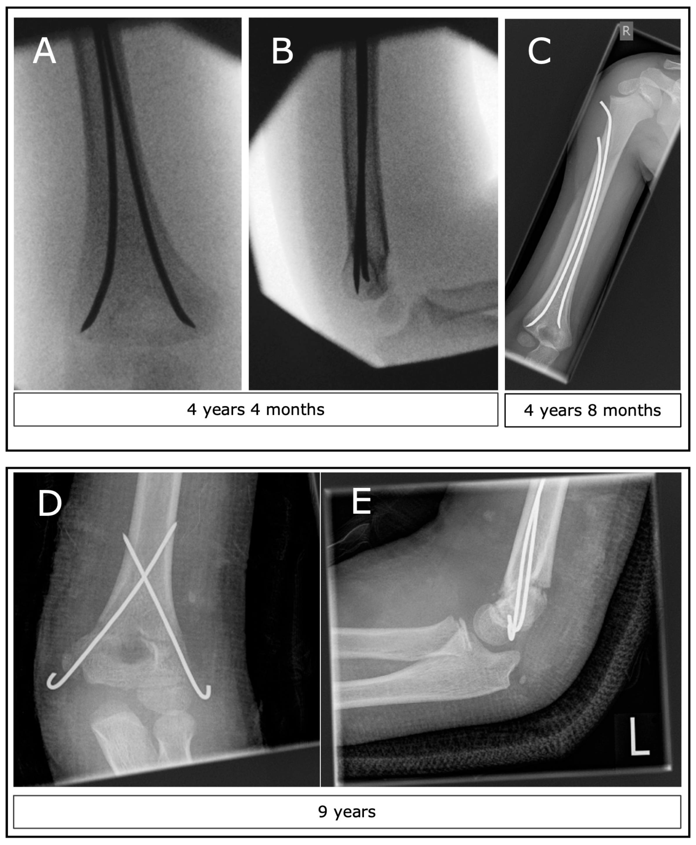 Children 11 00027 g001