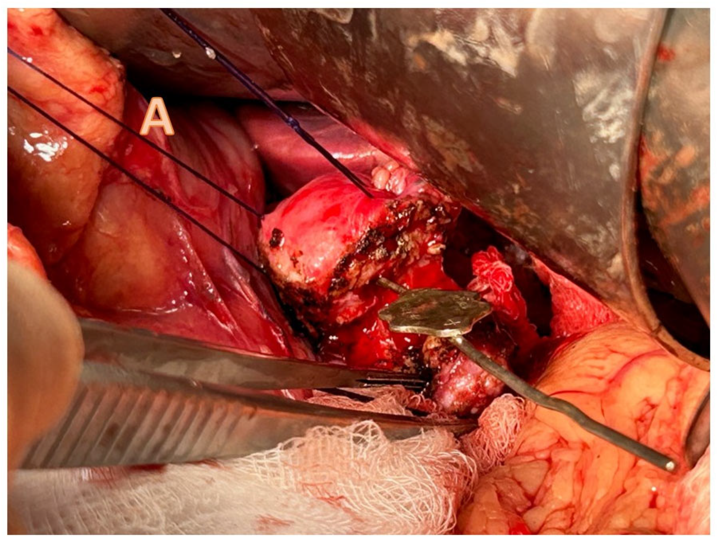 Children 11 00074 g004a