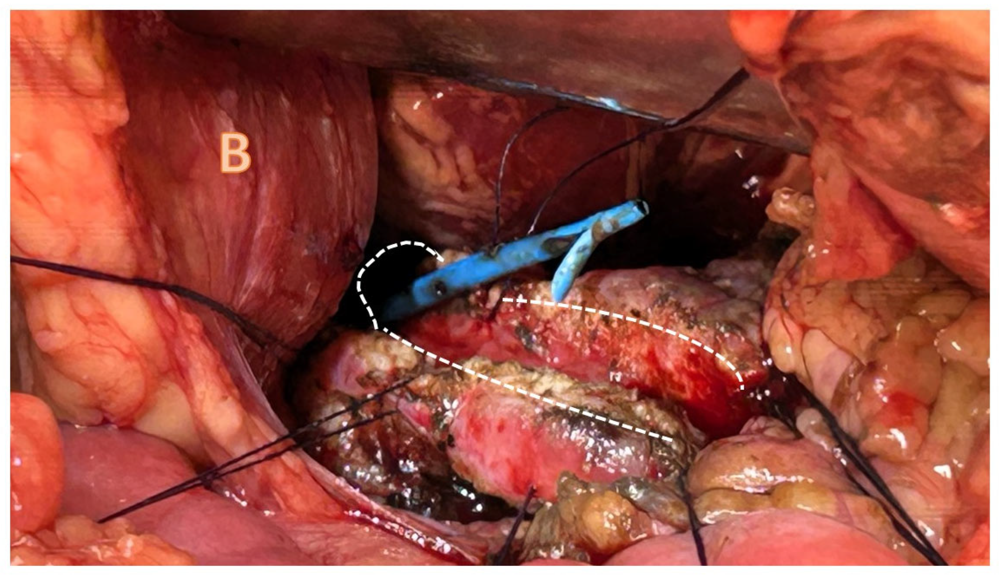 Children 11 00074 g004b