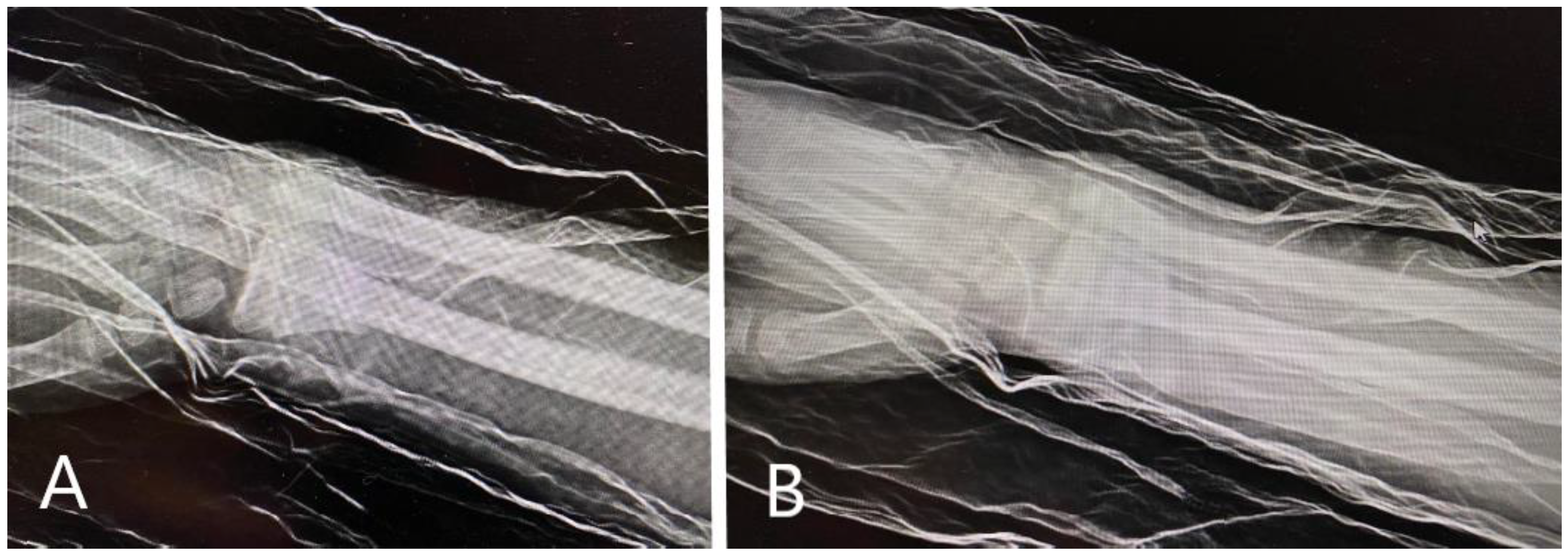 Children 11 00116 g001