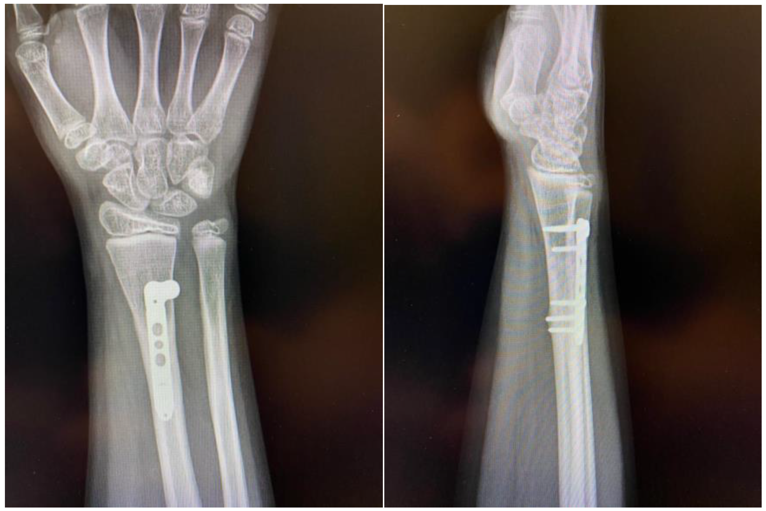 Children 11 00116 g006