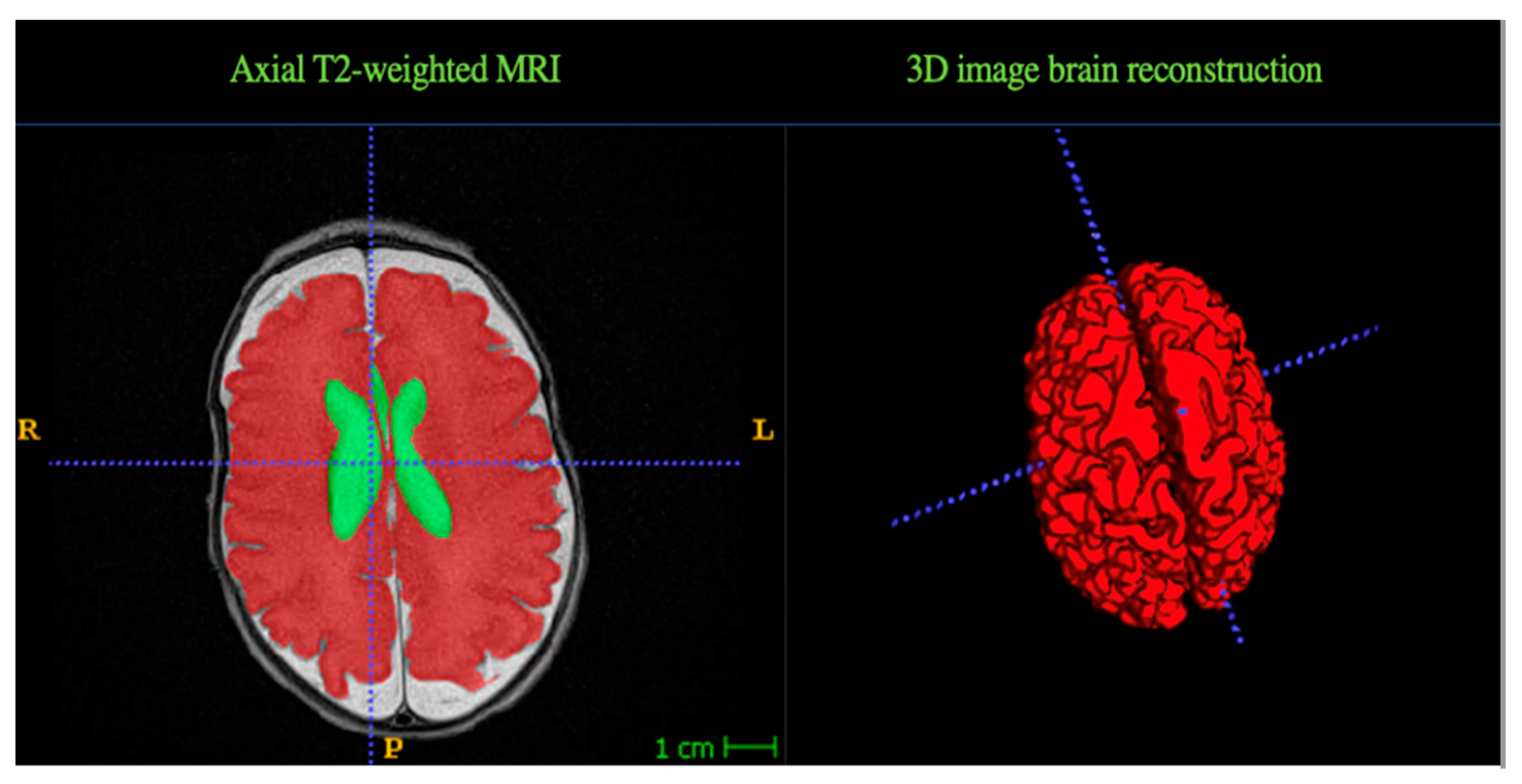 Children 11 00121 g001