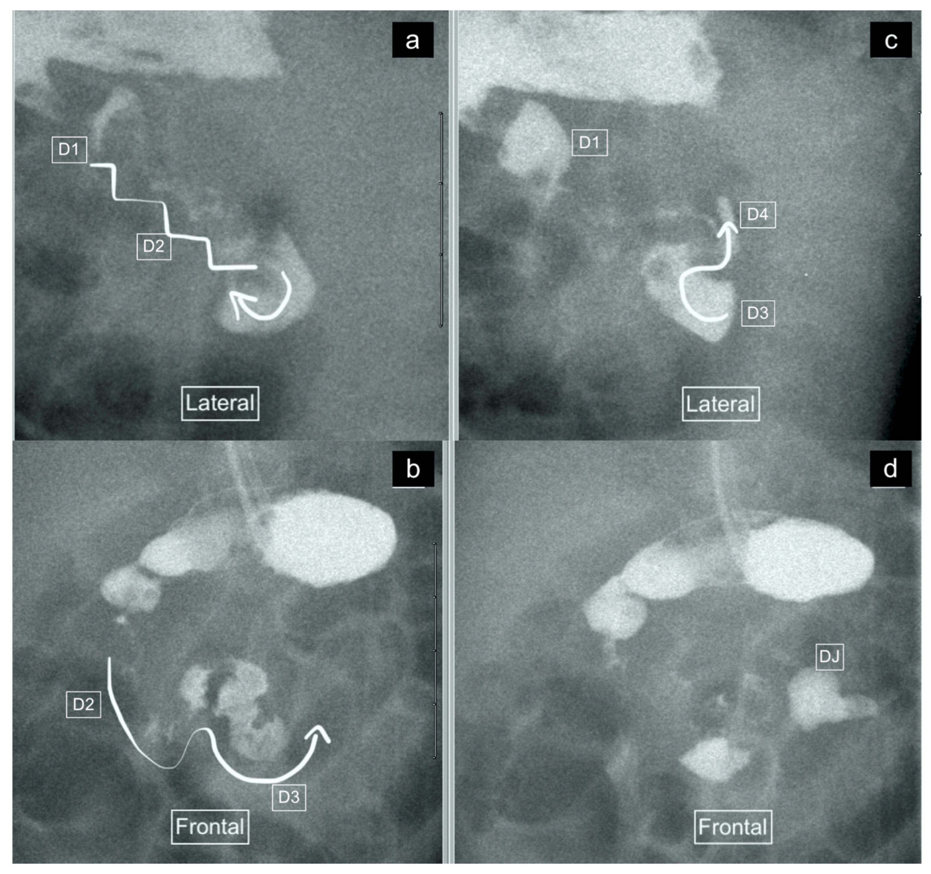 Children 11 00151 g003