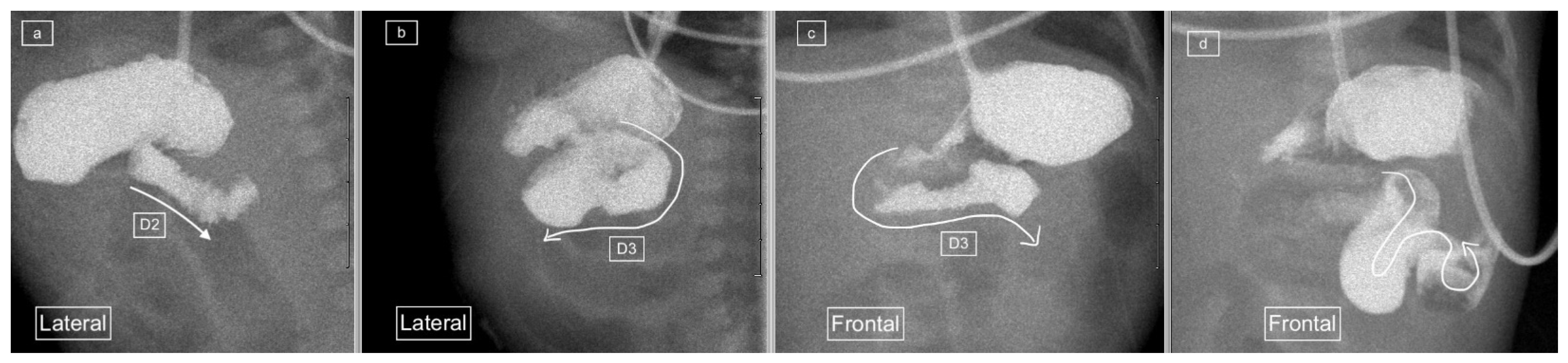 Children 11 00151 g005