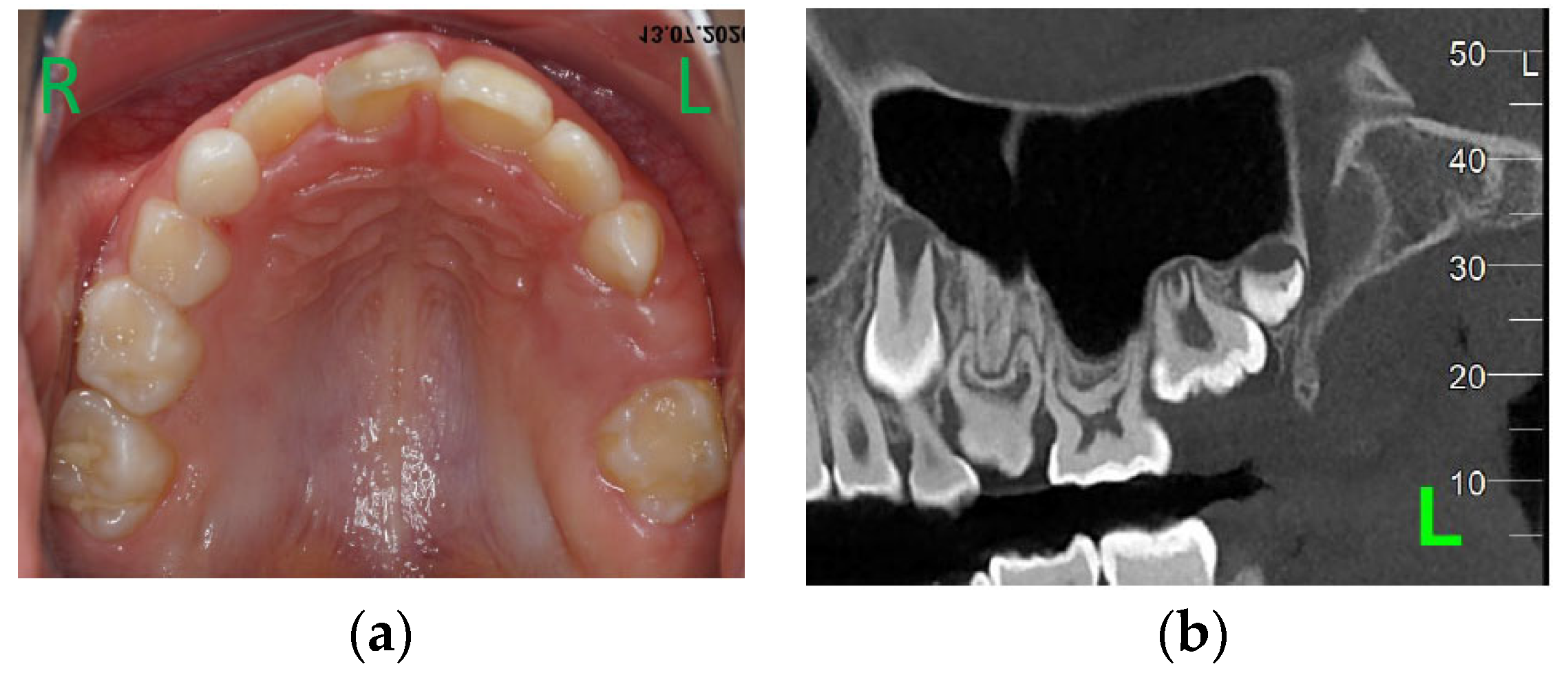 Children 11 00152 g004