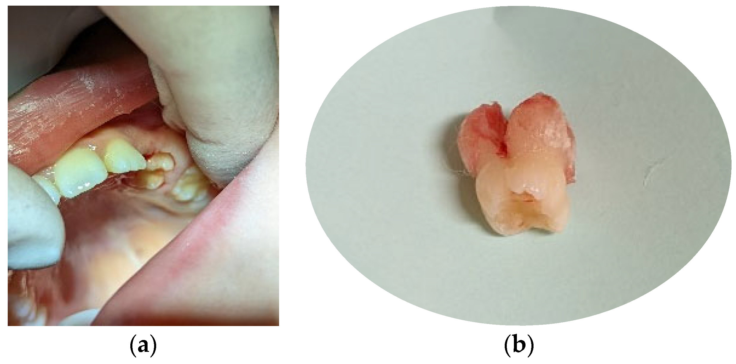 Children 11 00152 g006