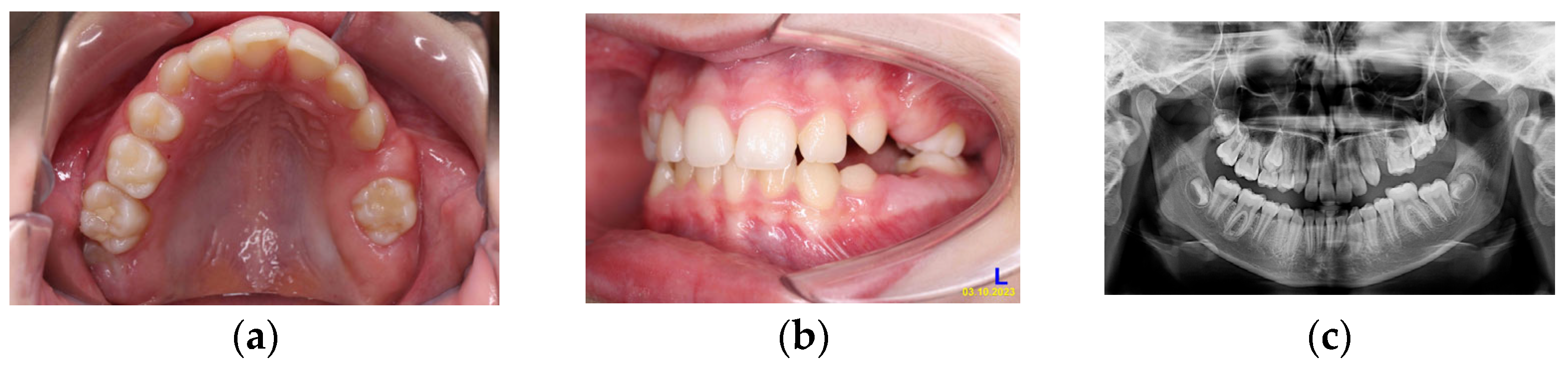 Children 11 00152 g008