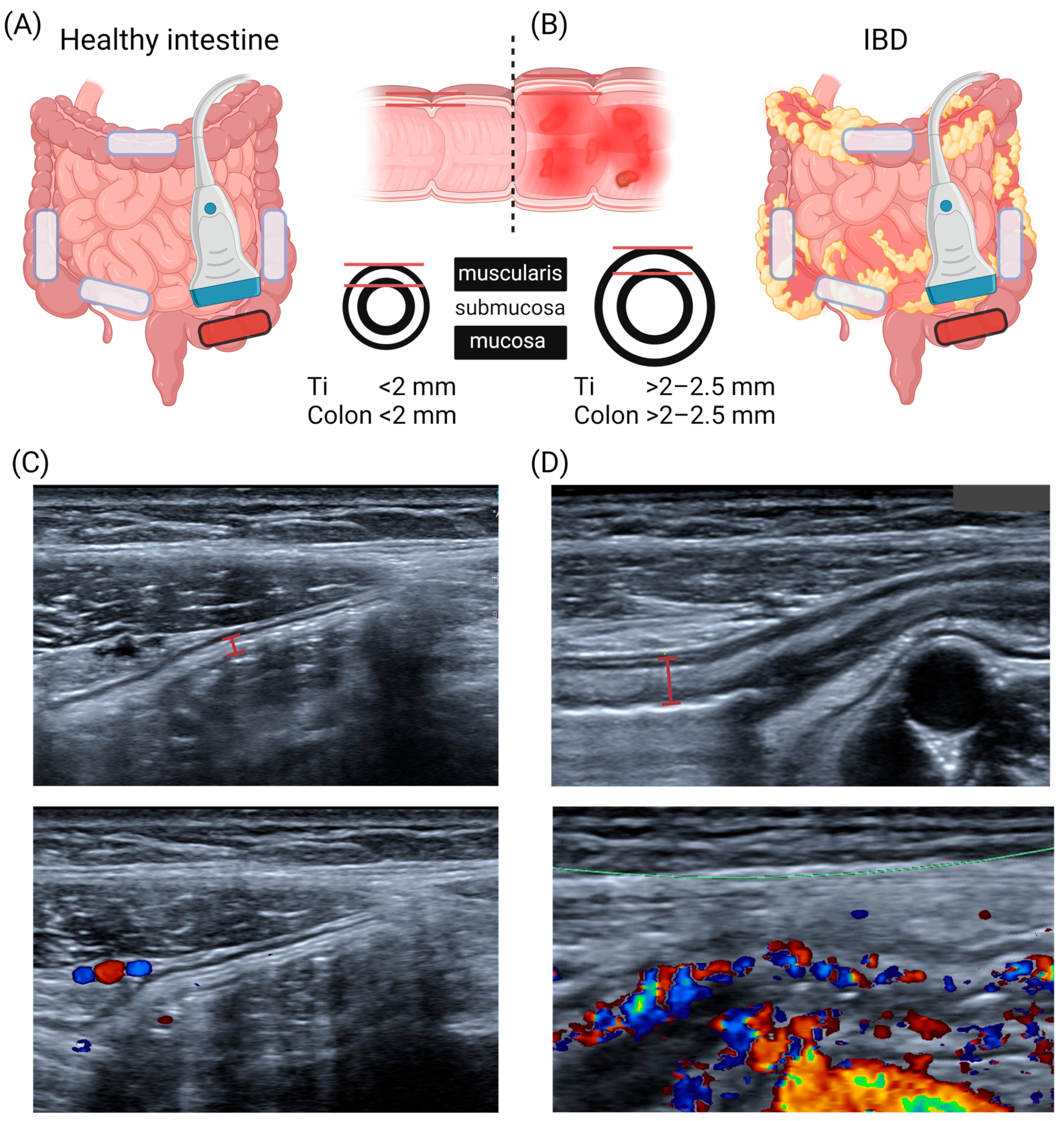 Children 11 00156 g001