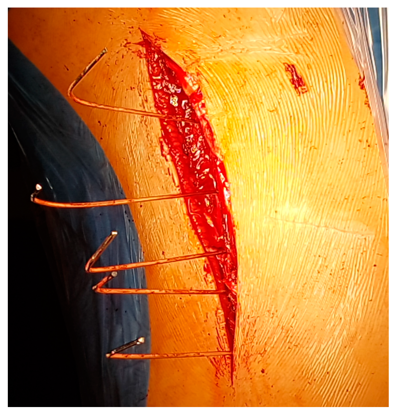 Children 11 00157 g003