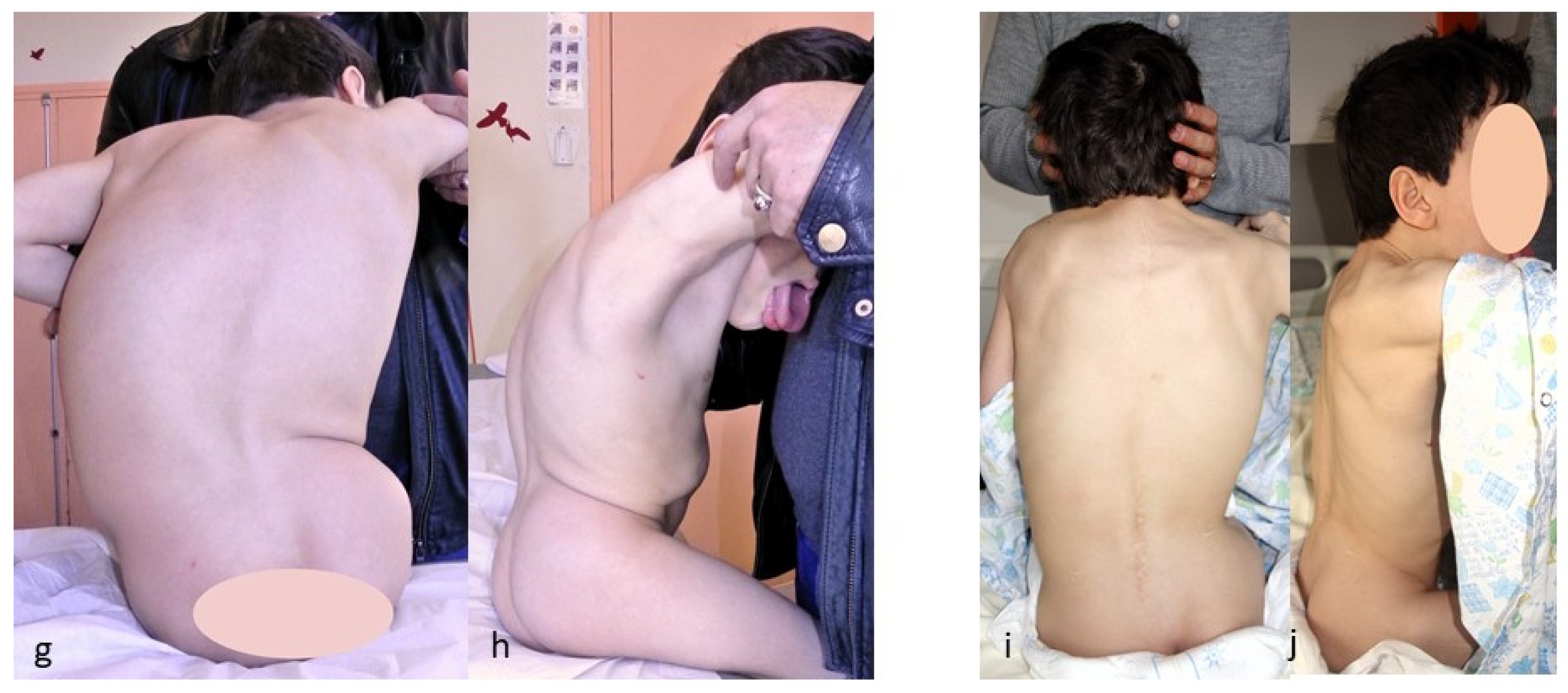 Children 11 00228 g004b