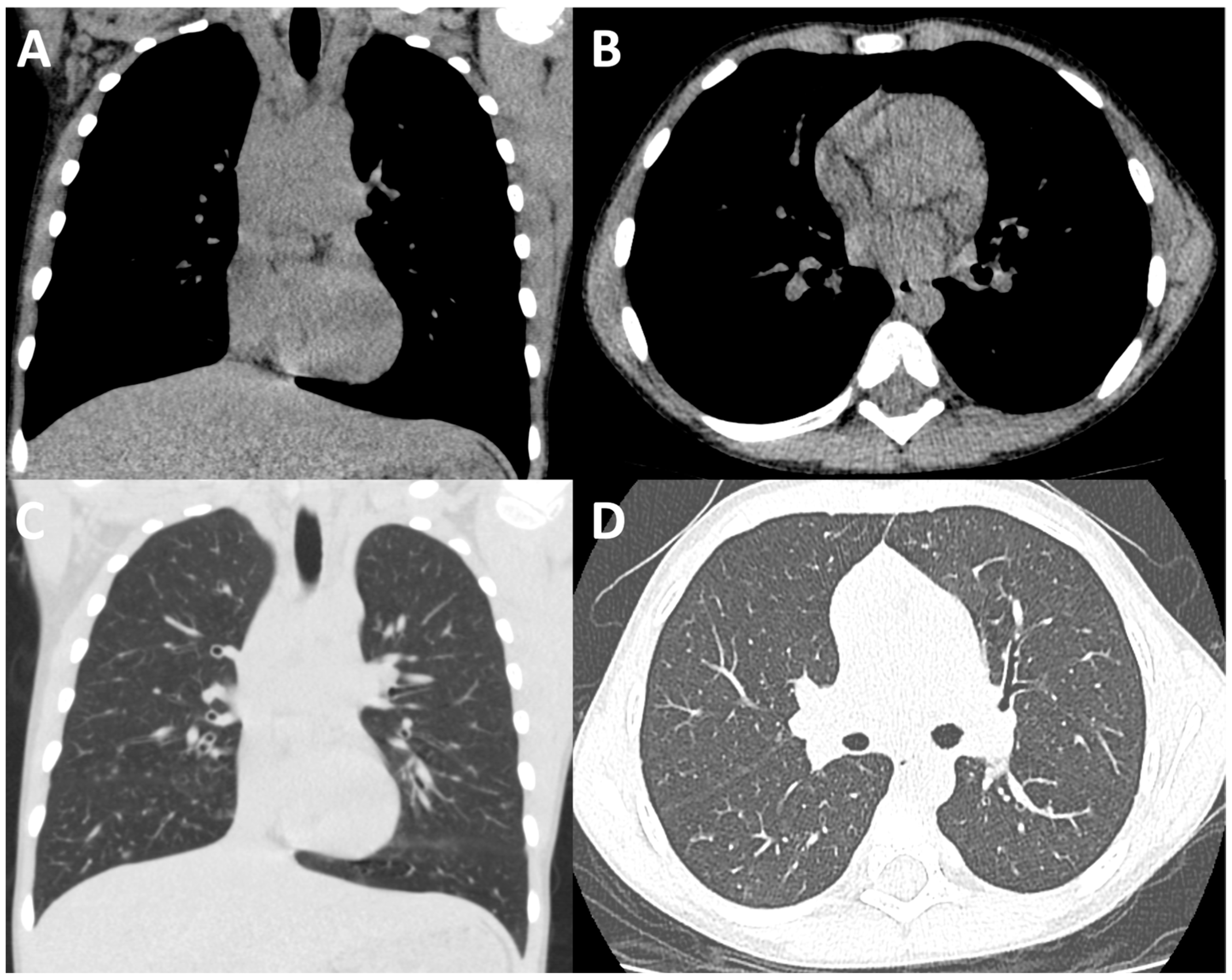 Children 11 00256 g001