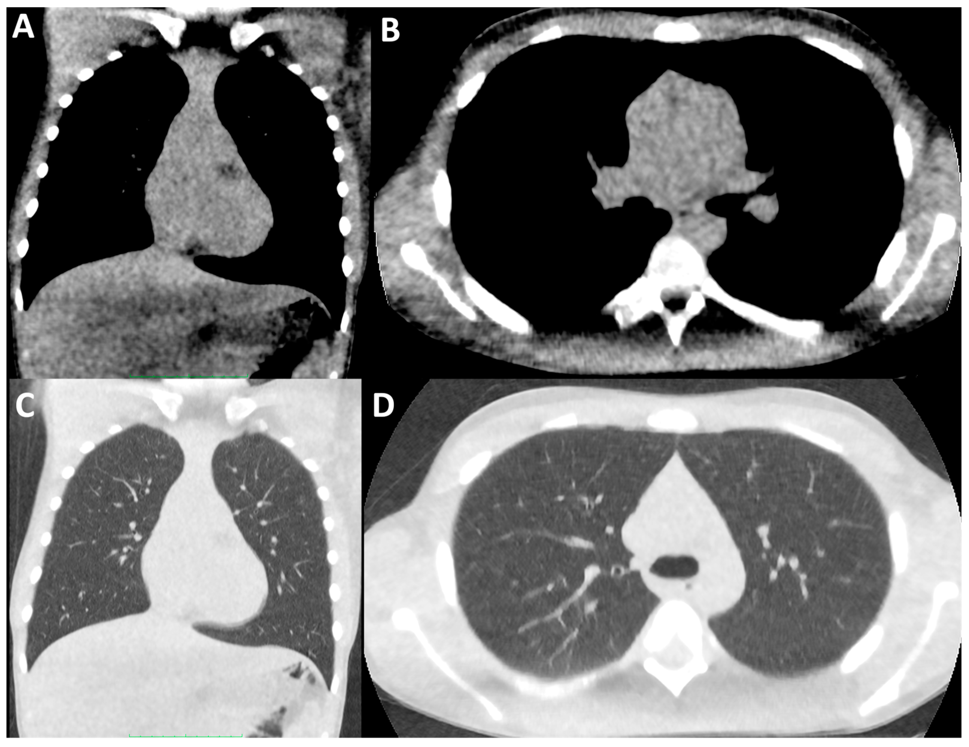 Children 11 00256 g002