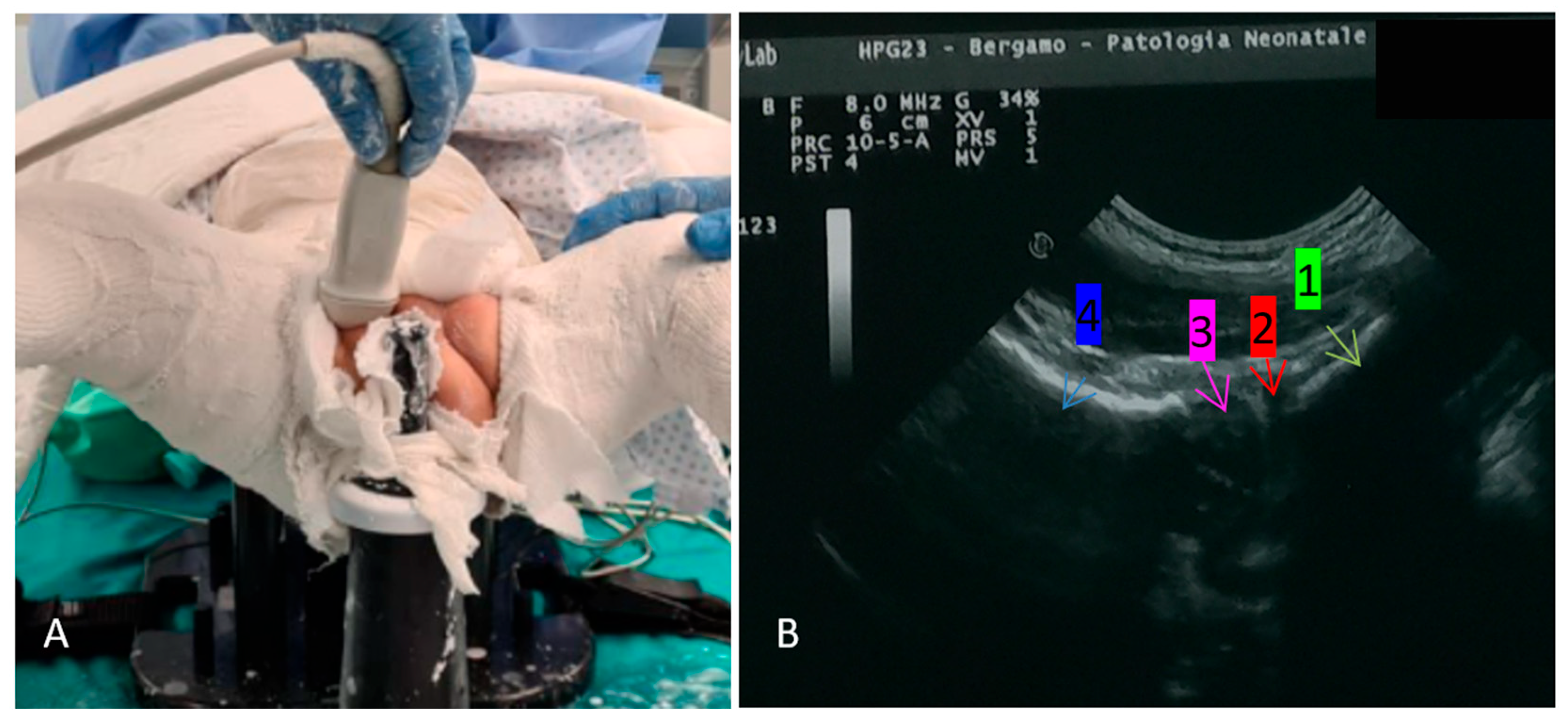 Children 11 00292 g002