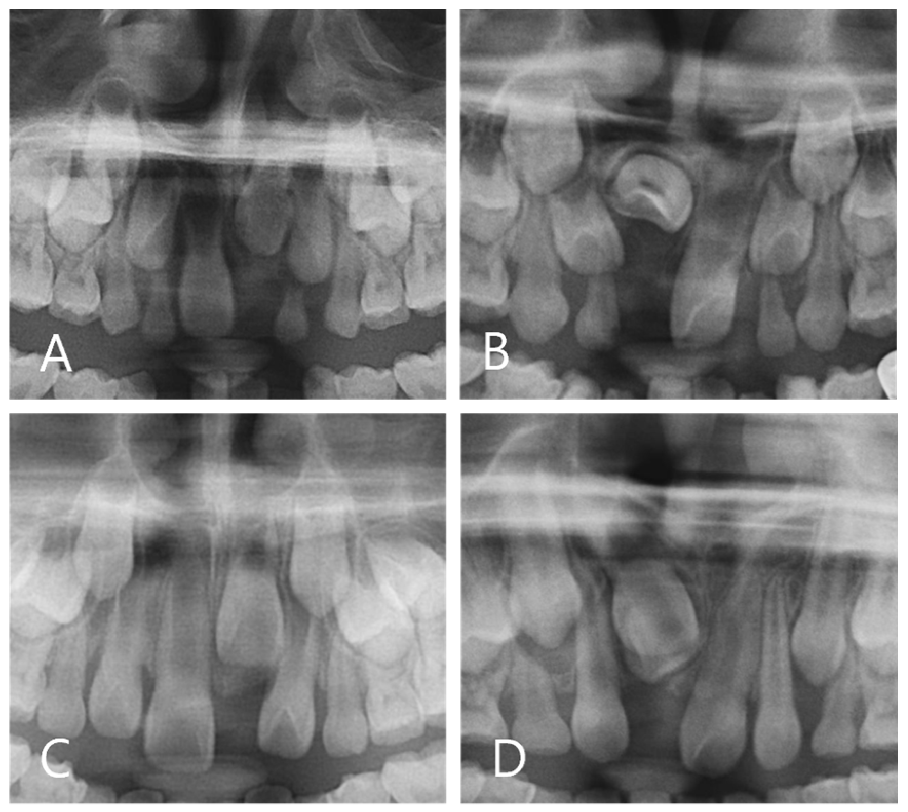 Children 11 00307 g001