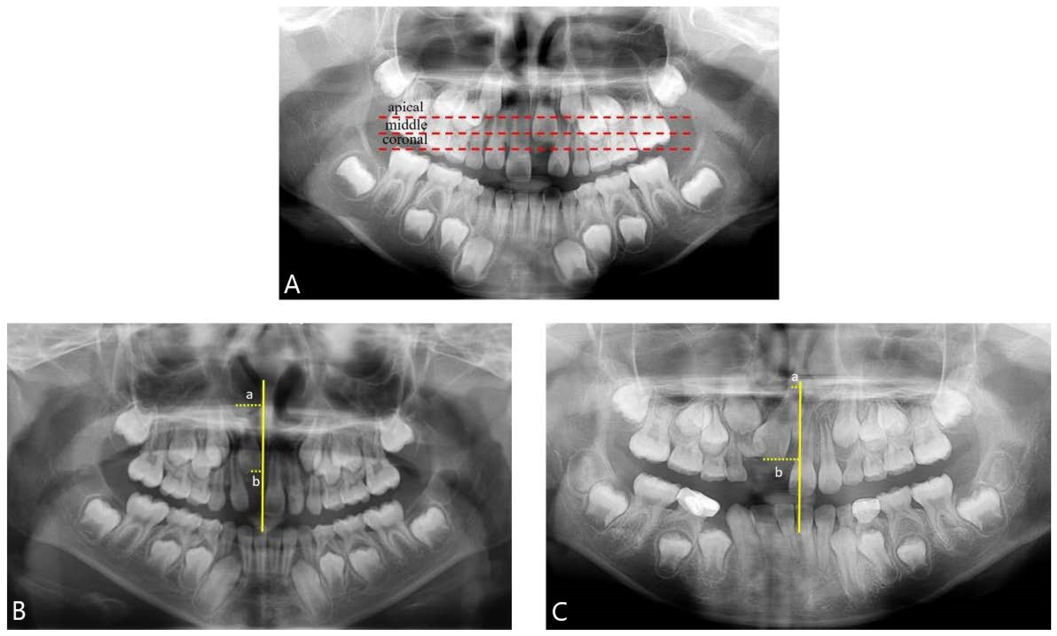 Children 11 00307 g002