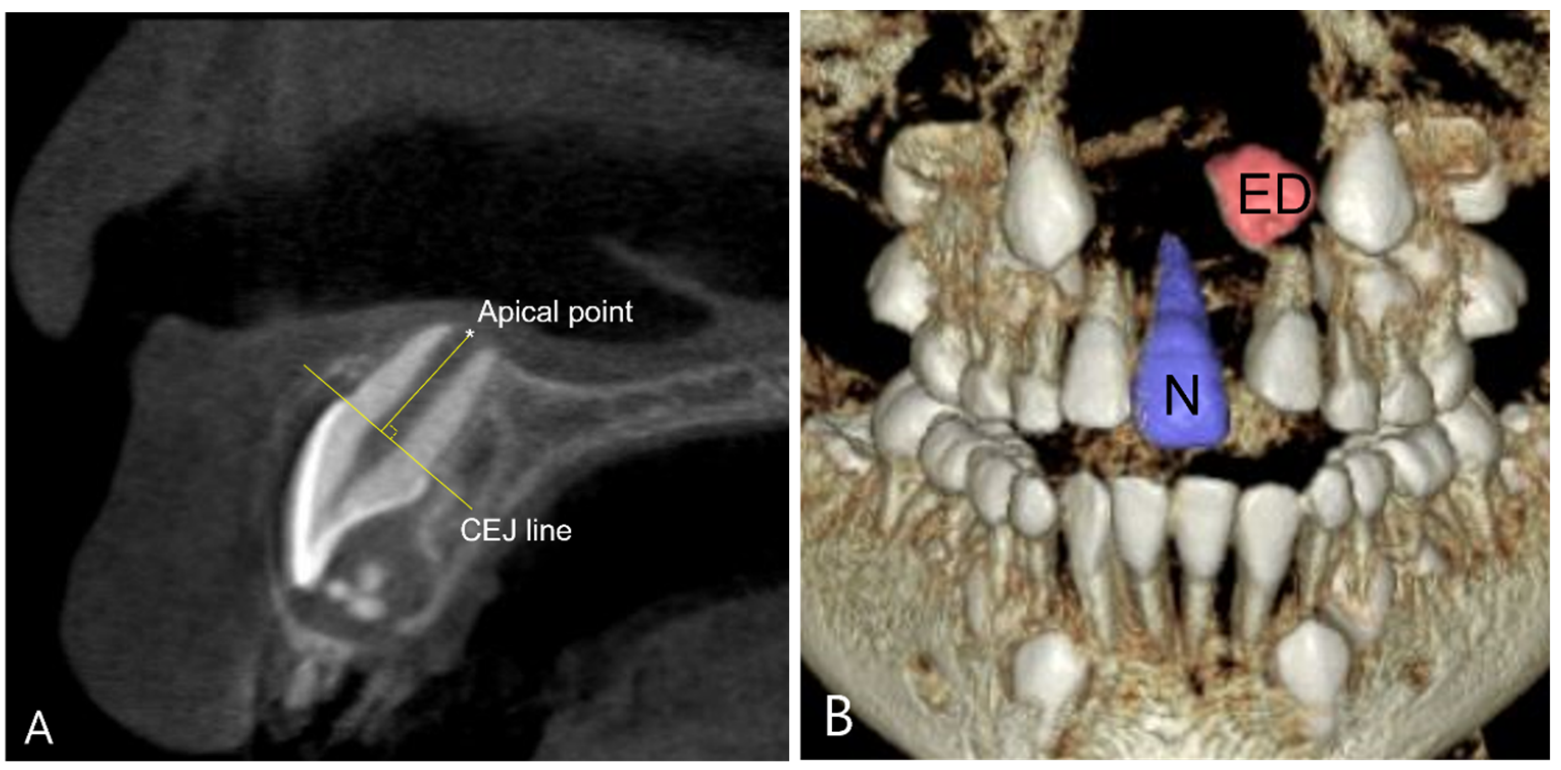 Children 11 00307 g003