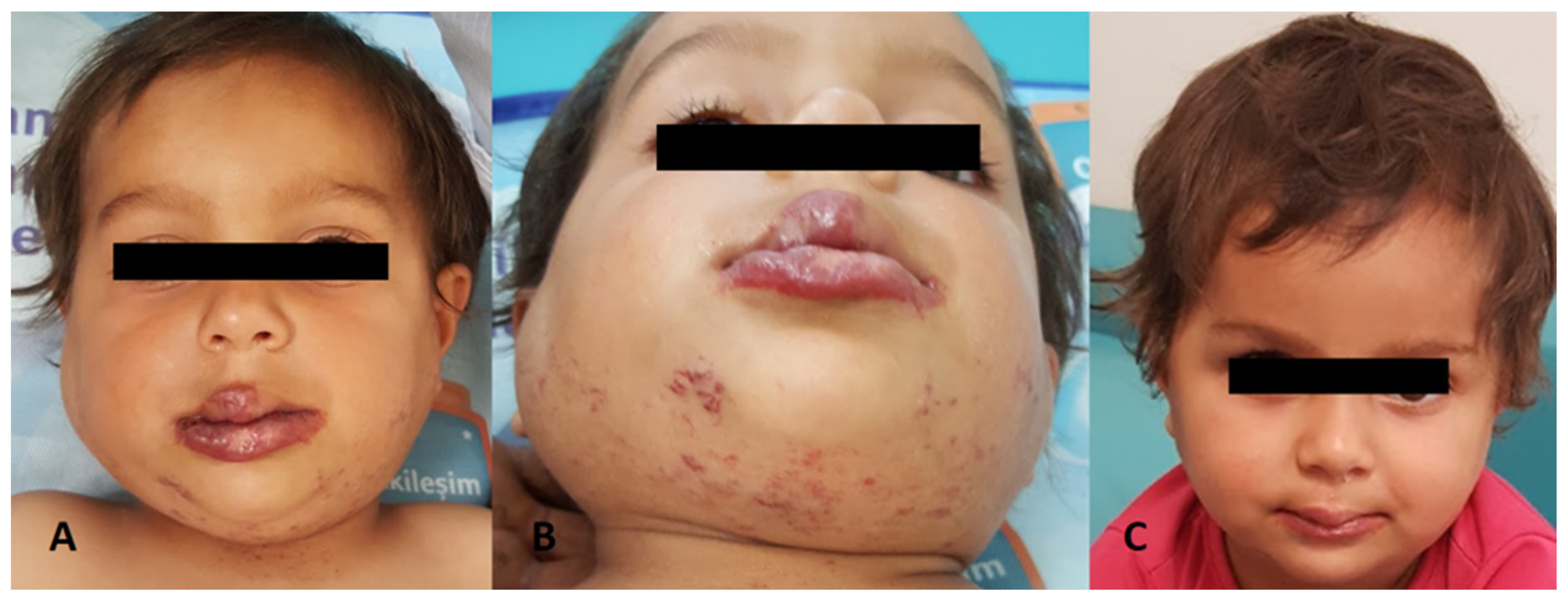 Children 11 00311 g001