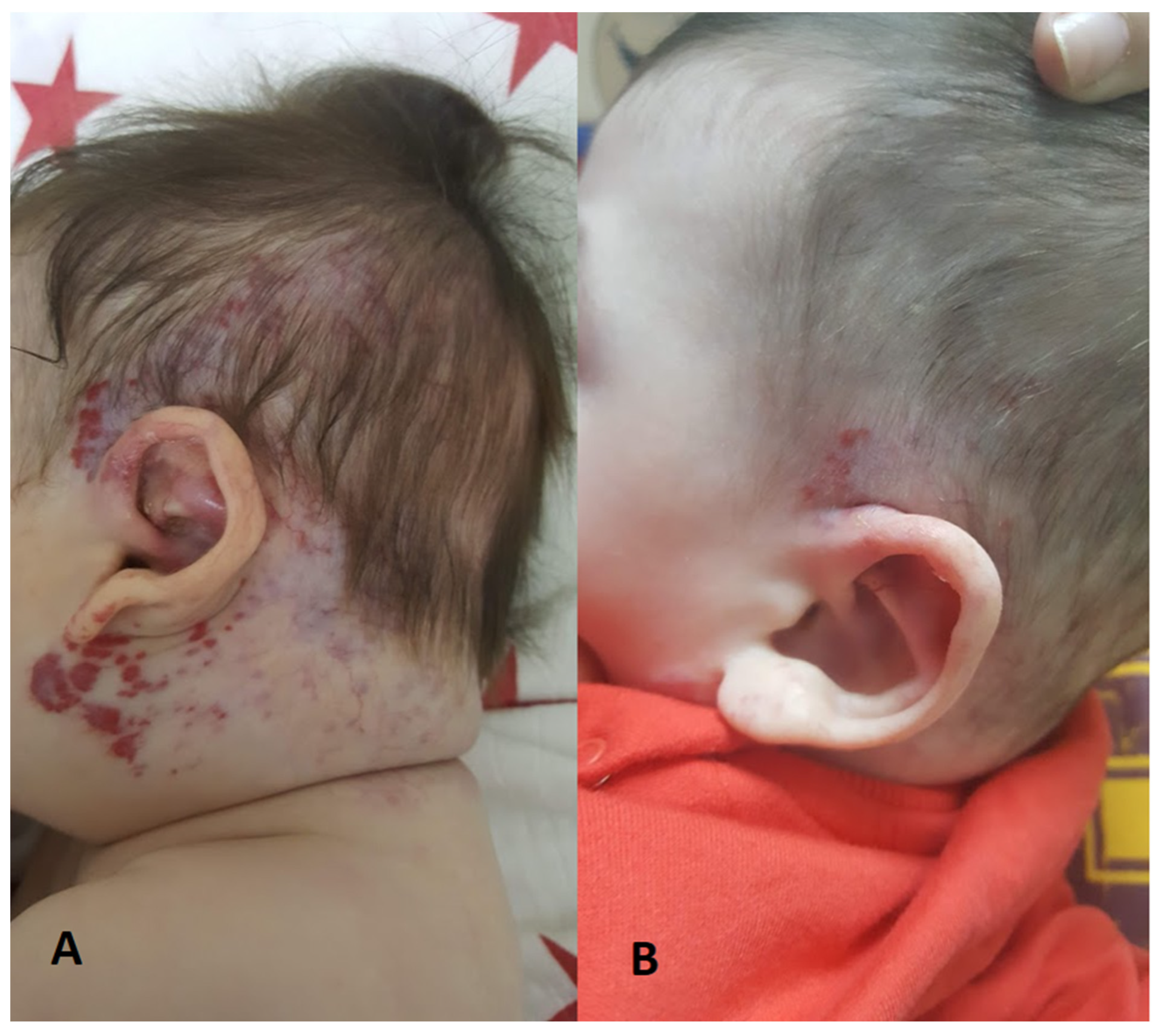 Children 11 00311 g002