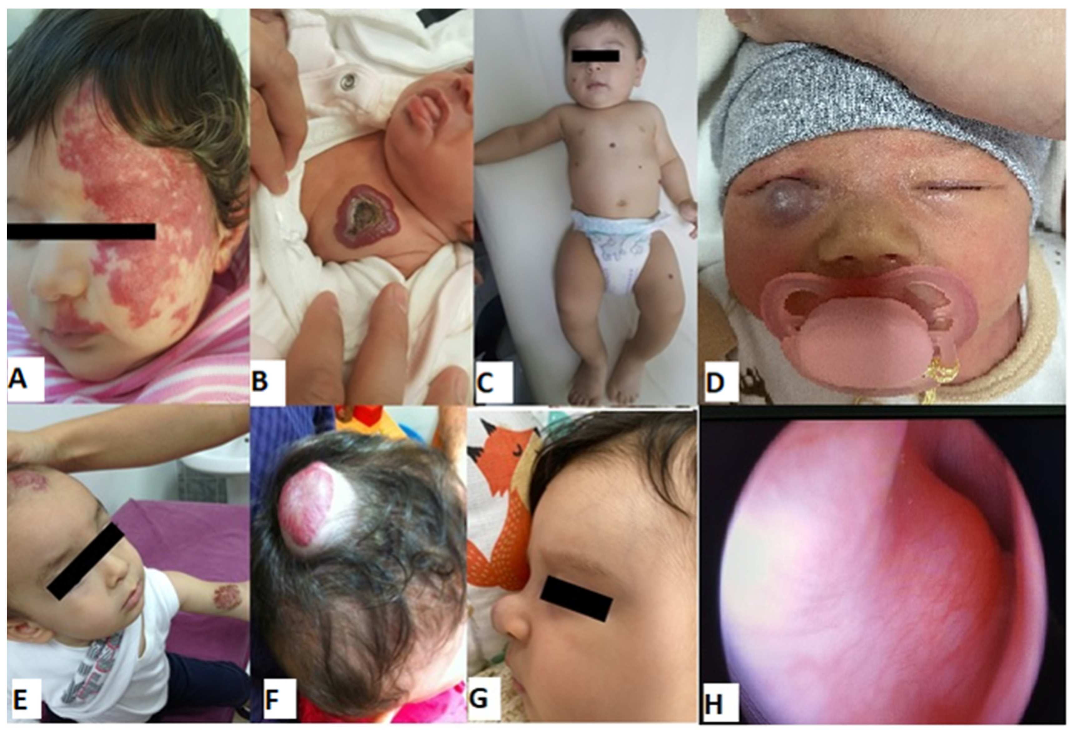 Children 11 00311 g003