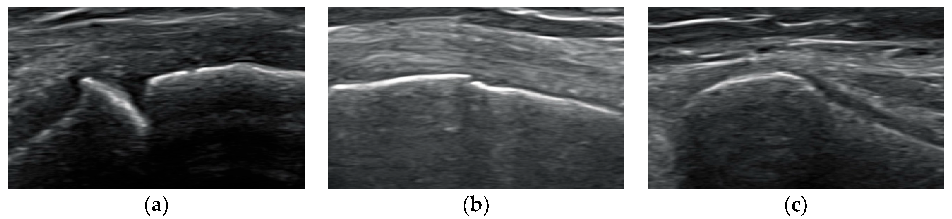 Children 11 00326 g001