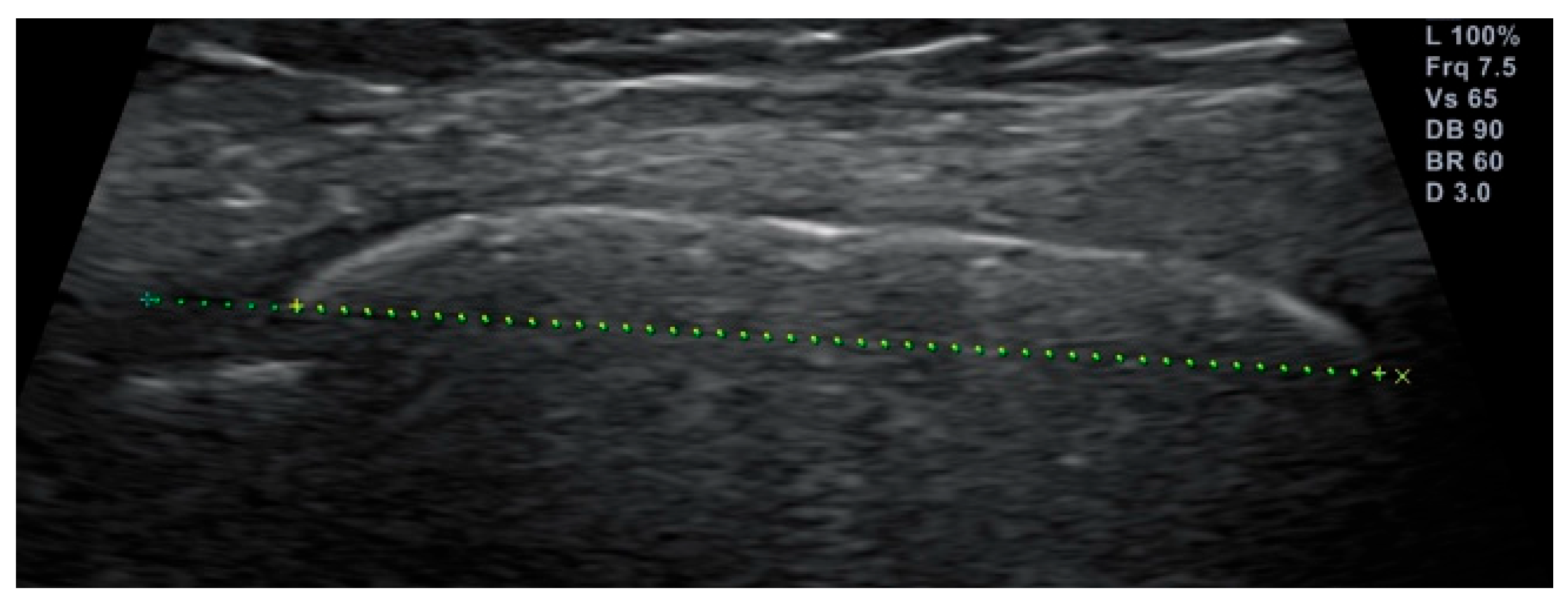 Children 11 00326 g002