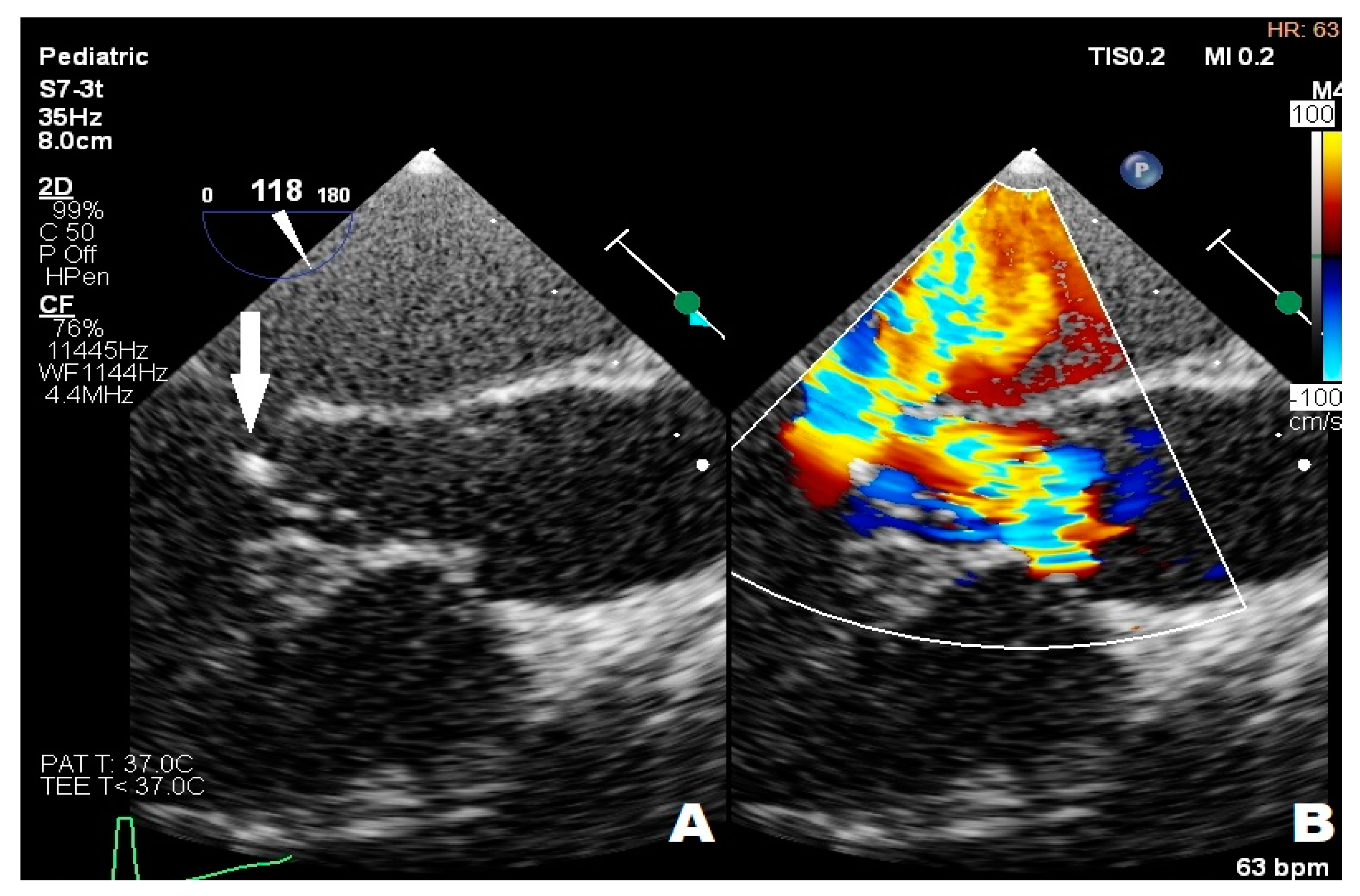 Children 11 00371 g003