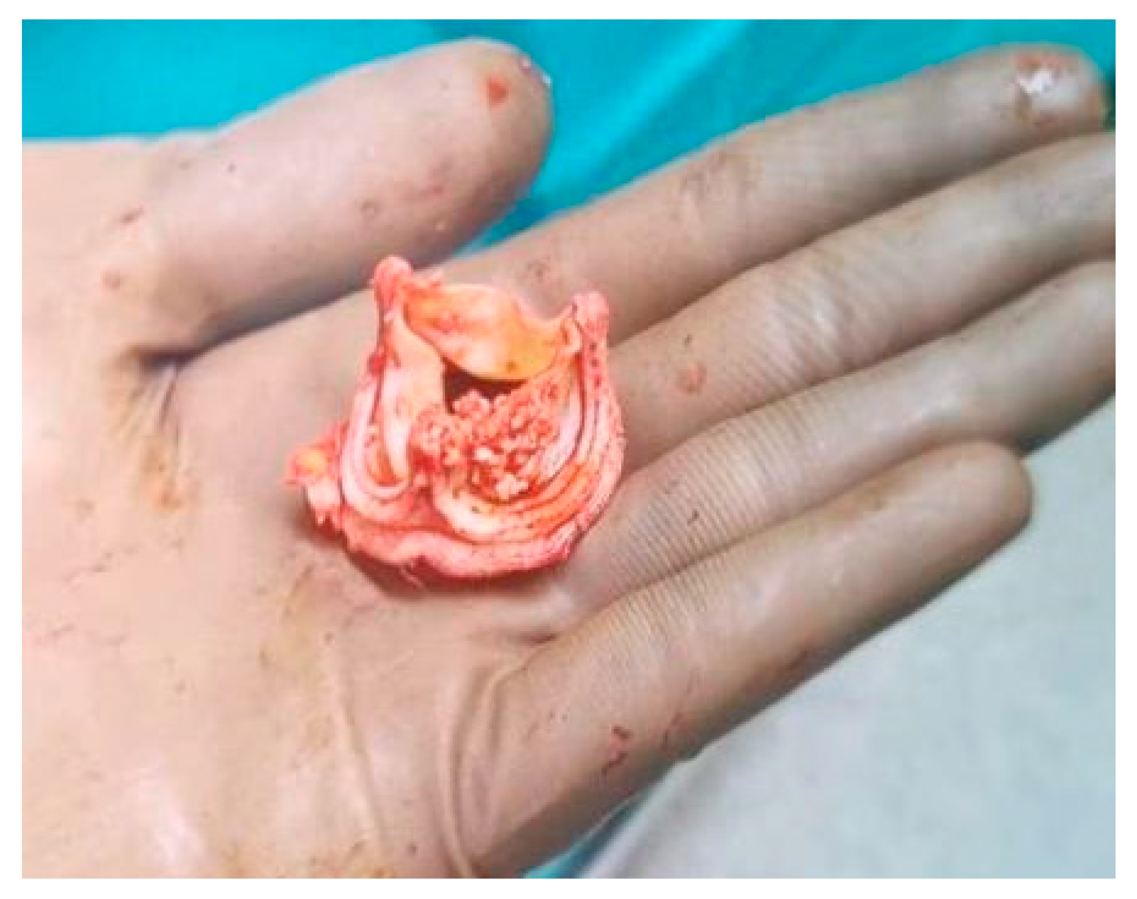 Children 11 00371 g007