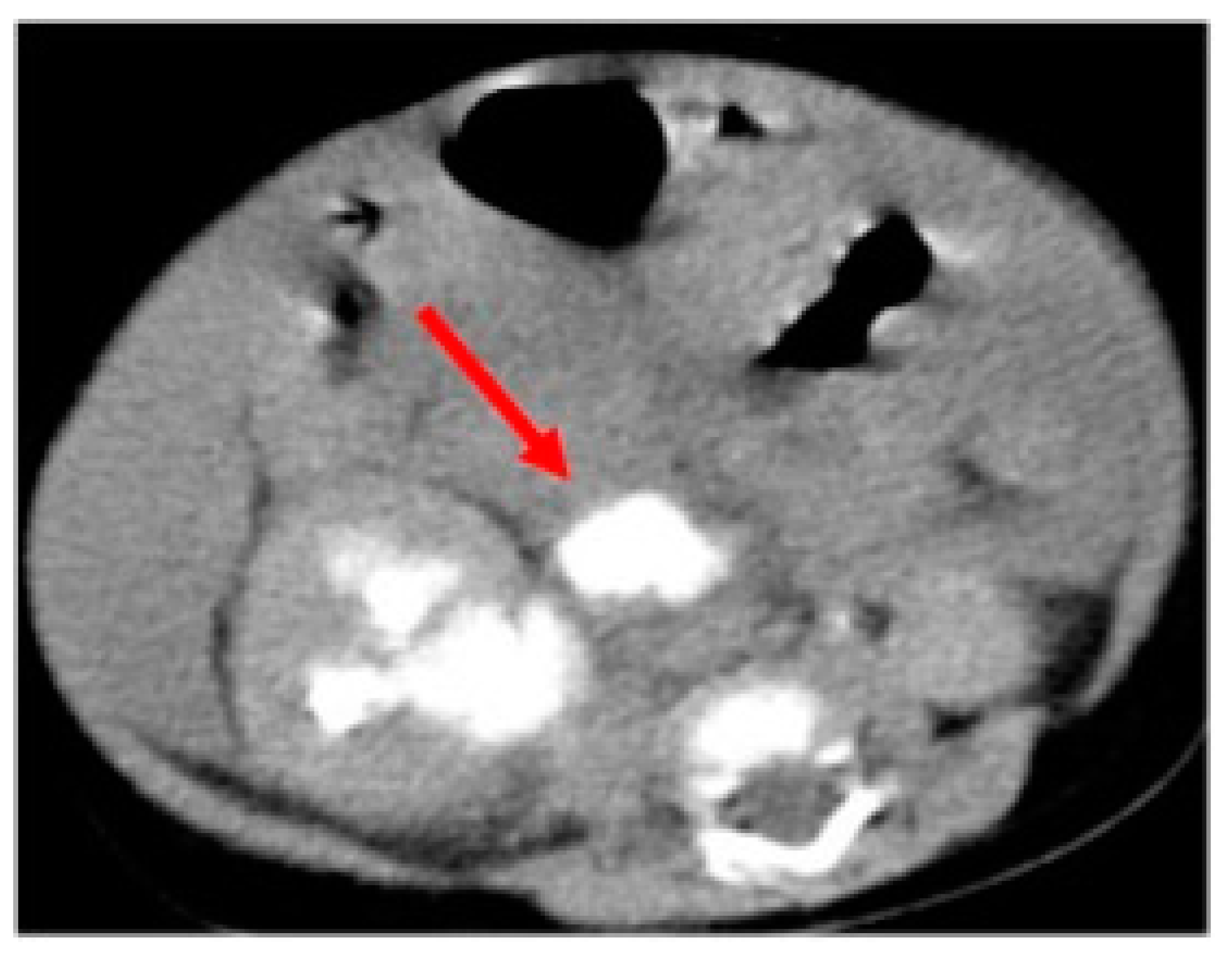 Children 11 00407 g001