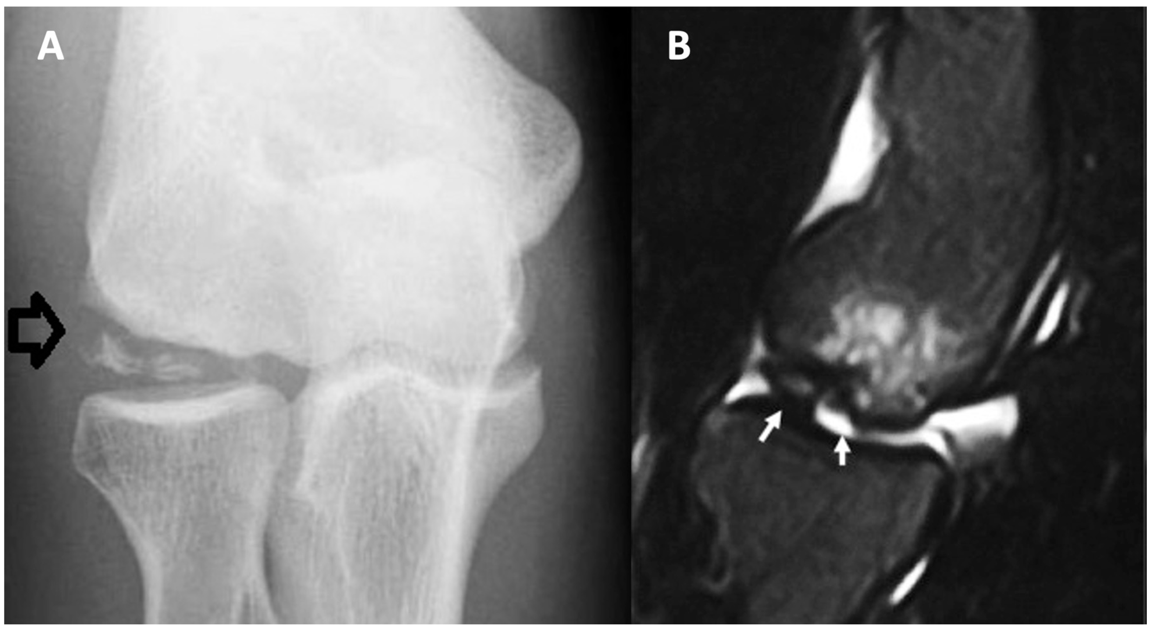 Children 11 00498 g001