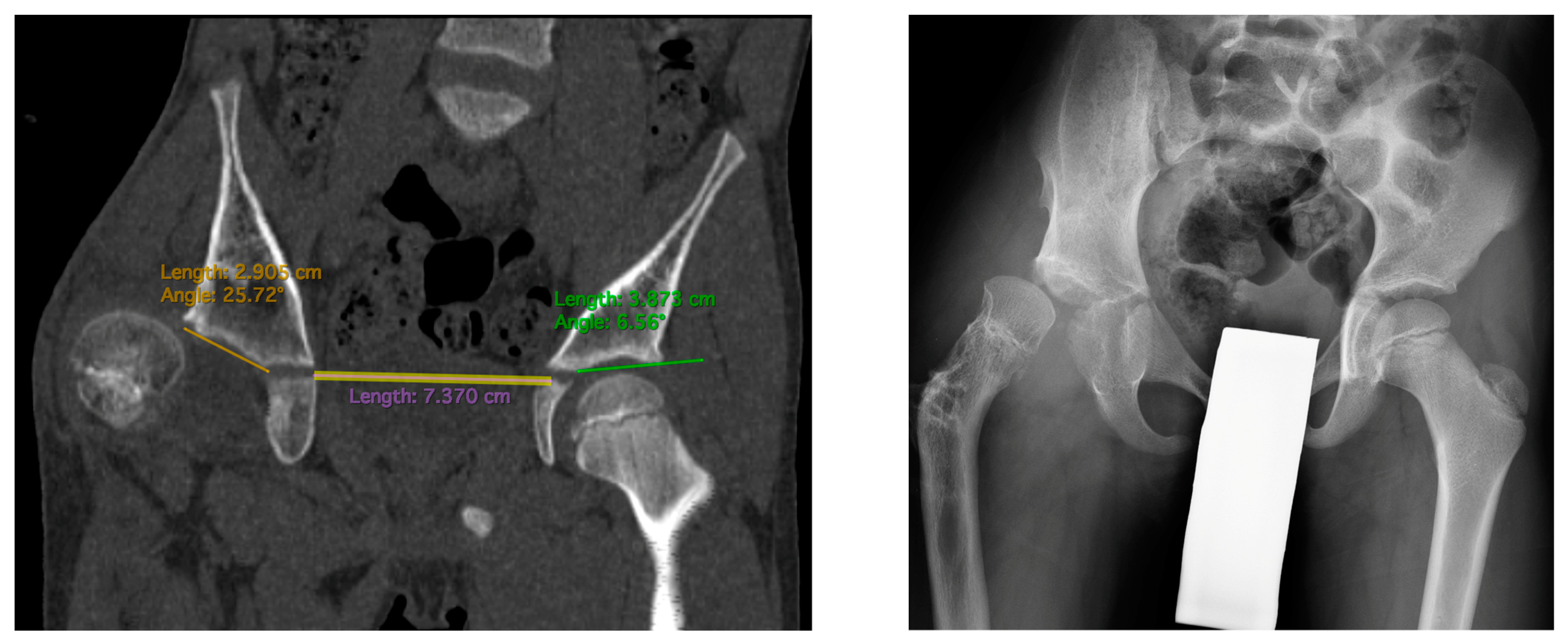 Children 11 00500 g003 Children 11 00500 g003