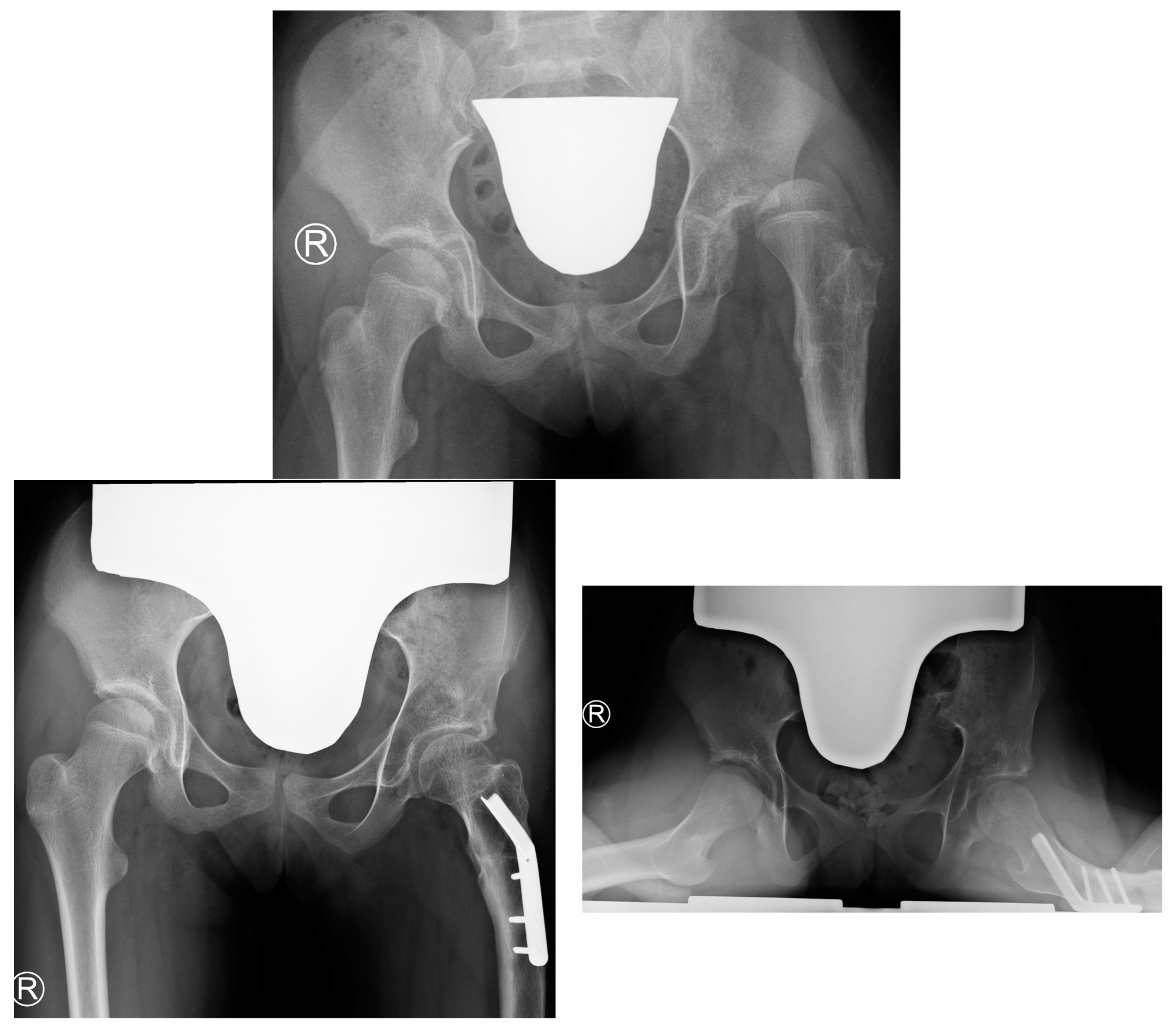 Children 11 00500 g004b Children 11 00500 g004b