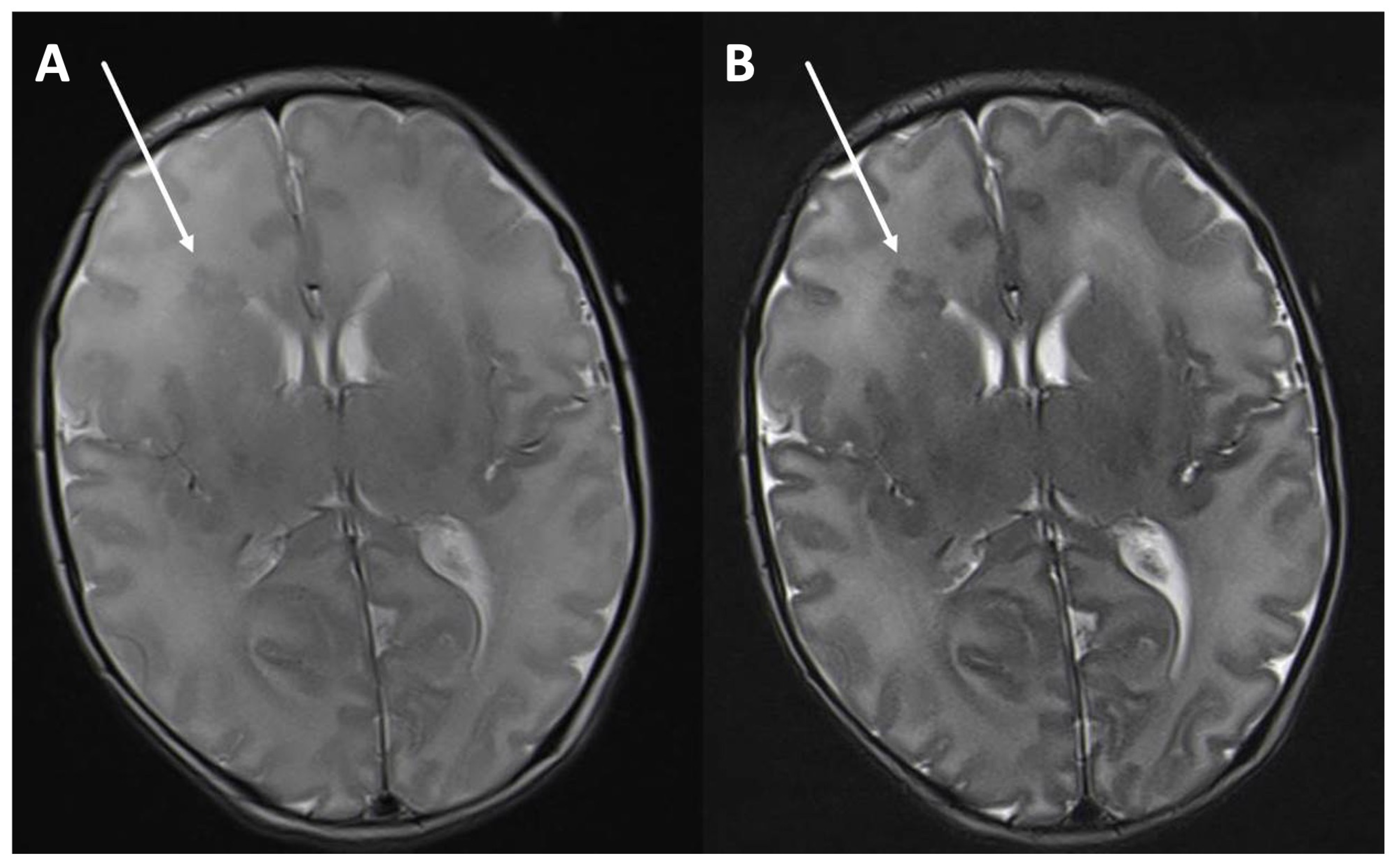 Children 11 00511 g002