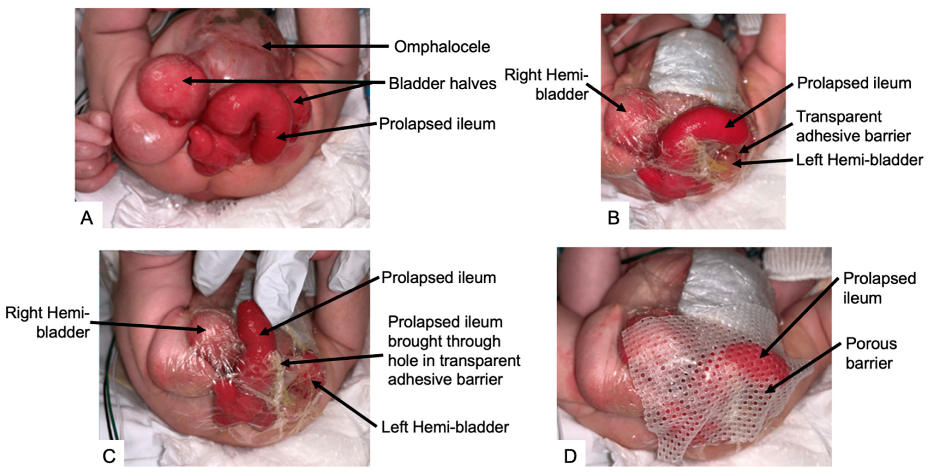 Children 11 00544 g003