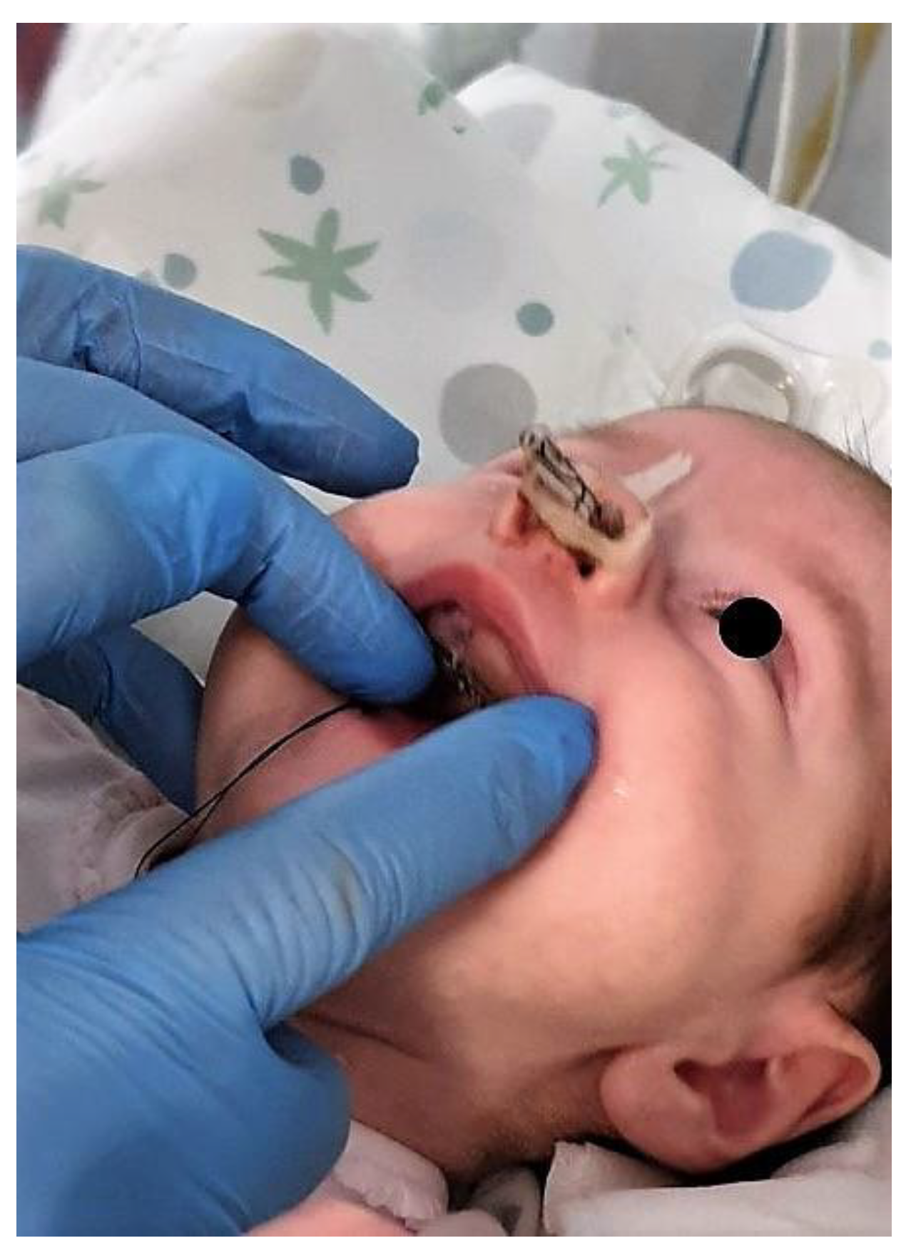 Children 11 00554 g002