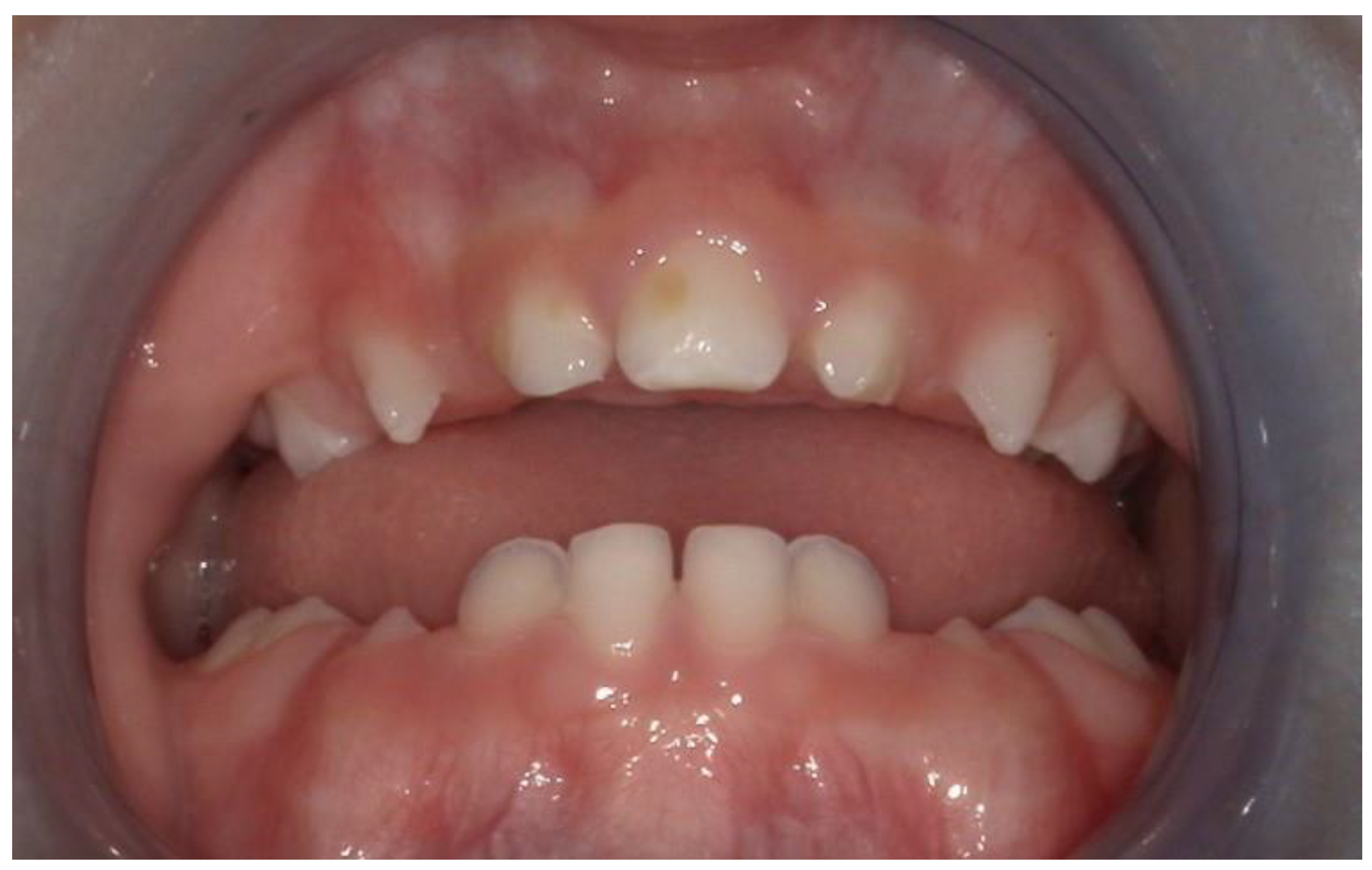 Children 11 00554 g004