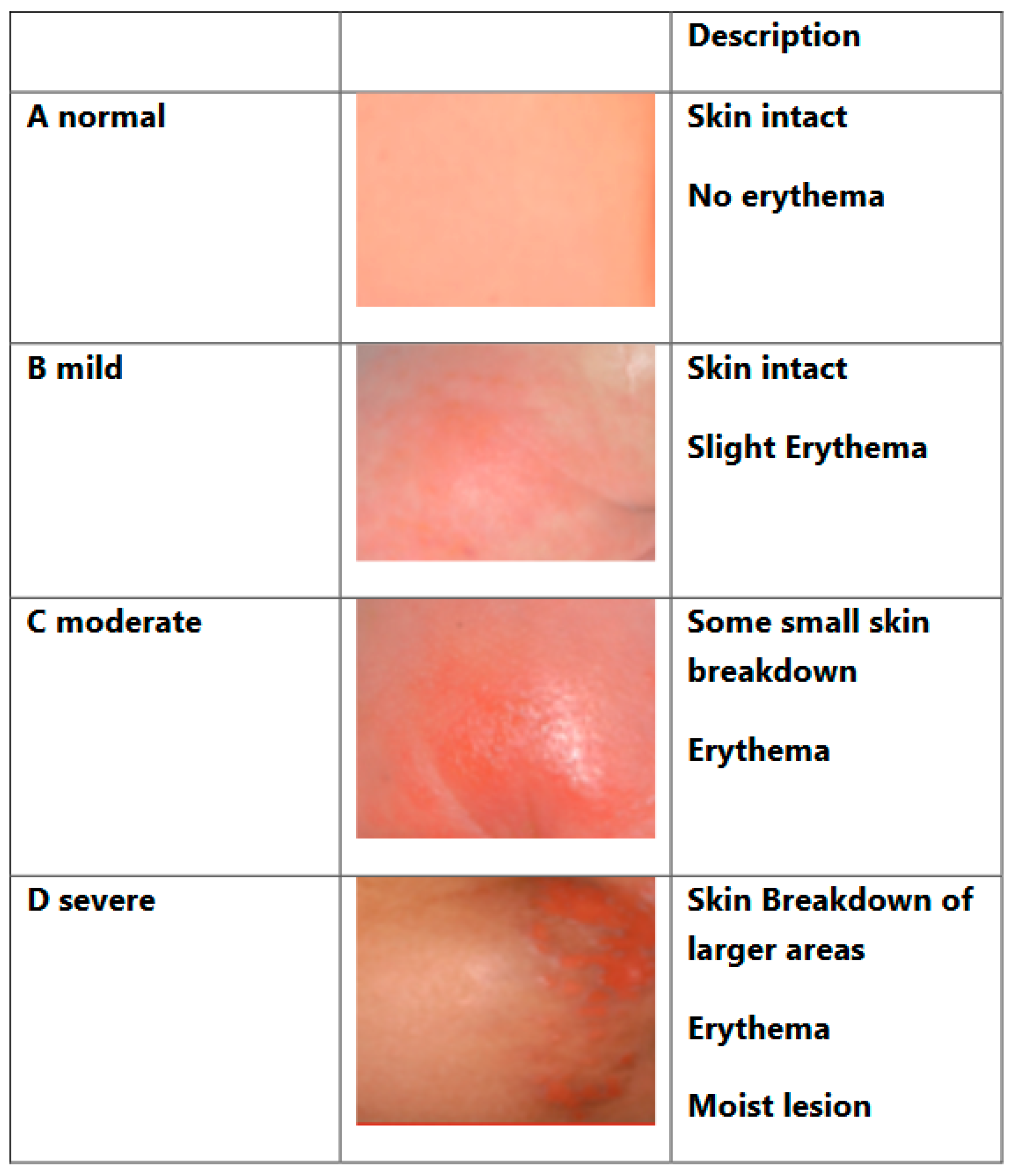 Children 11 00588 g001