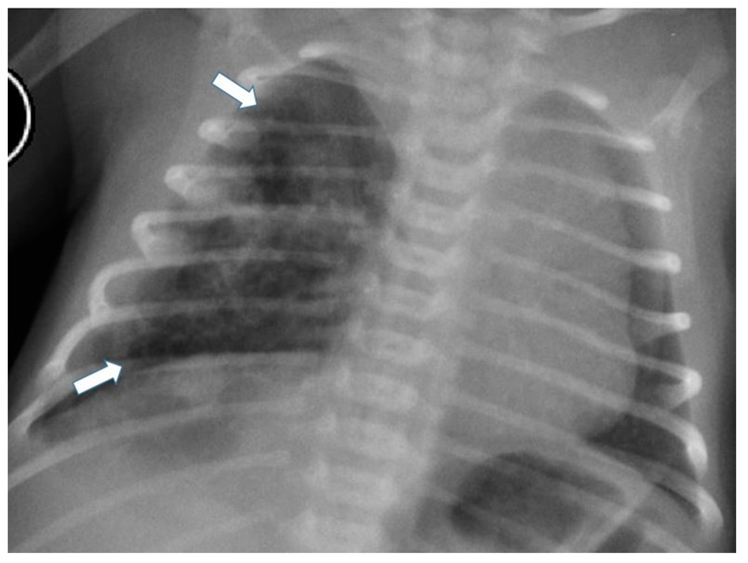 Children 11 00638 g004