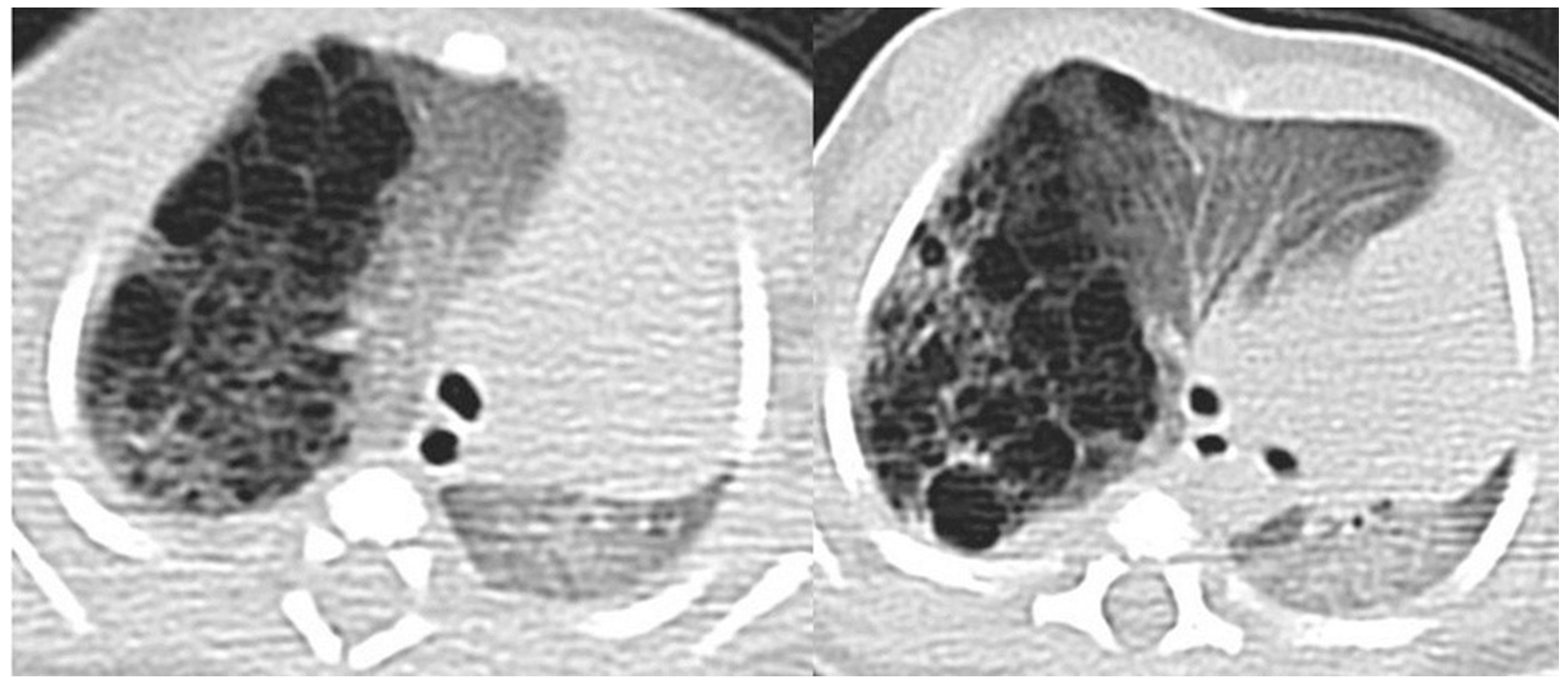 Children 11 00638 g007