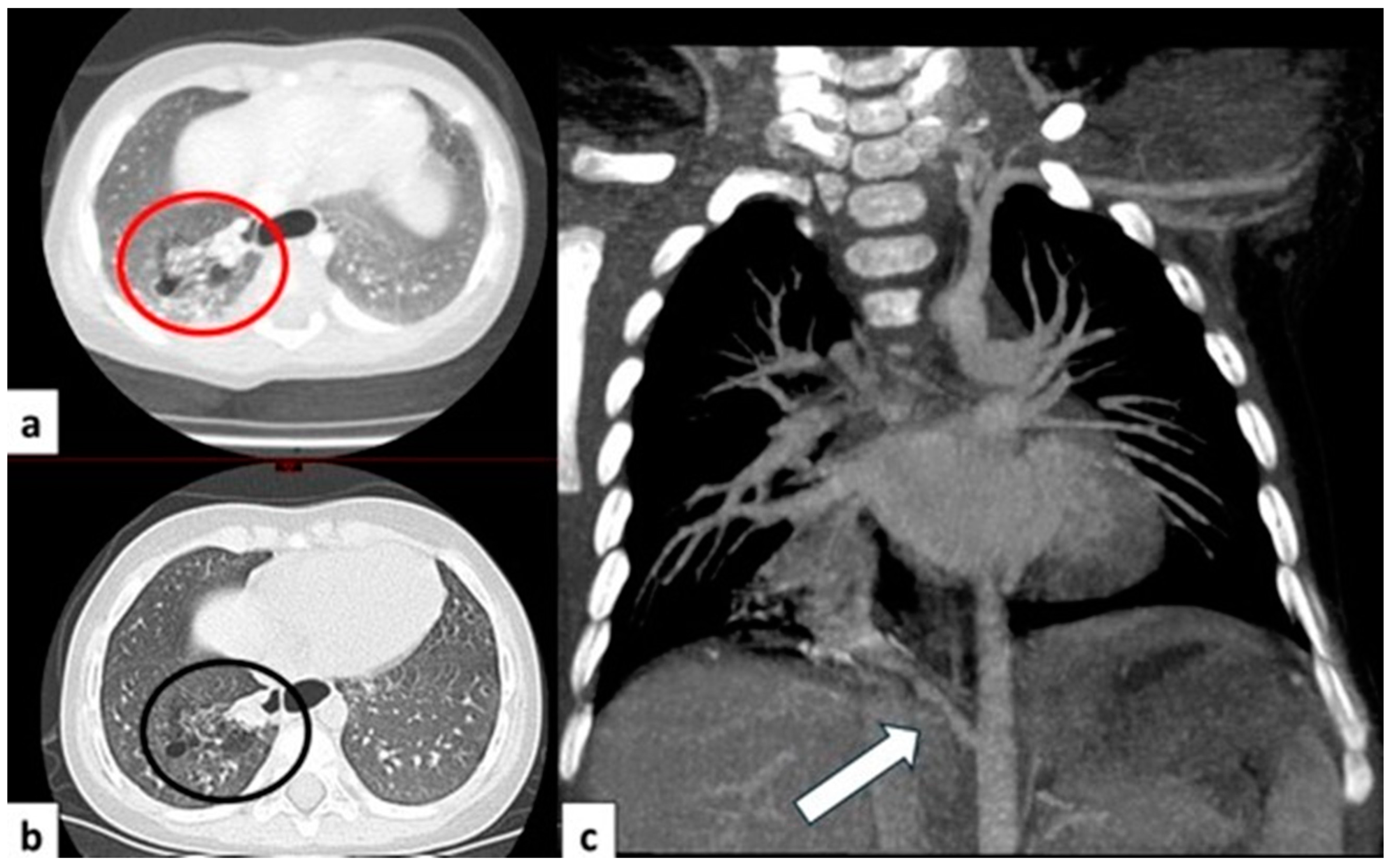 Children 11 00638 g008