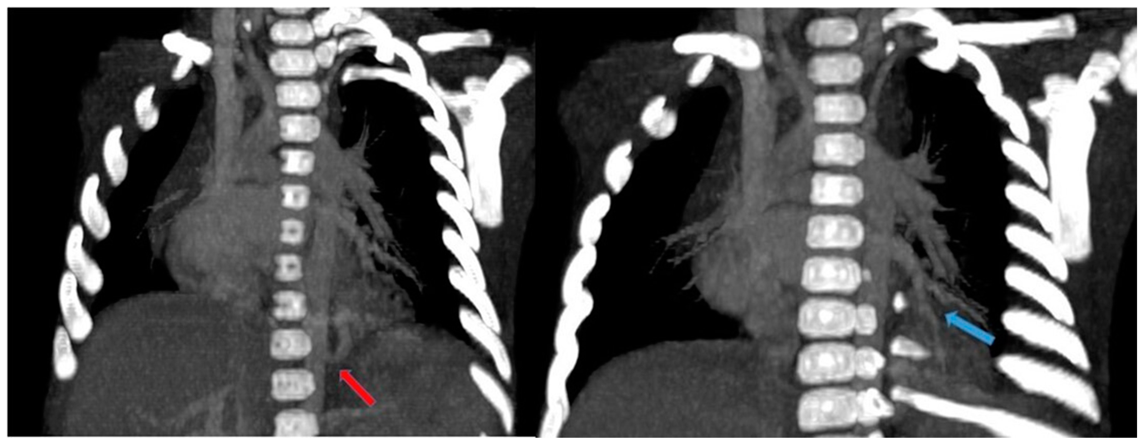 Children 11 00638 g015