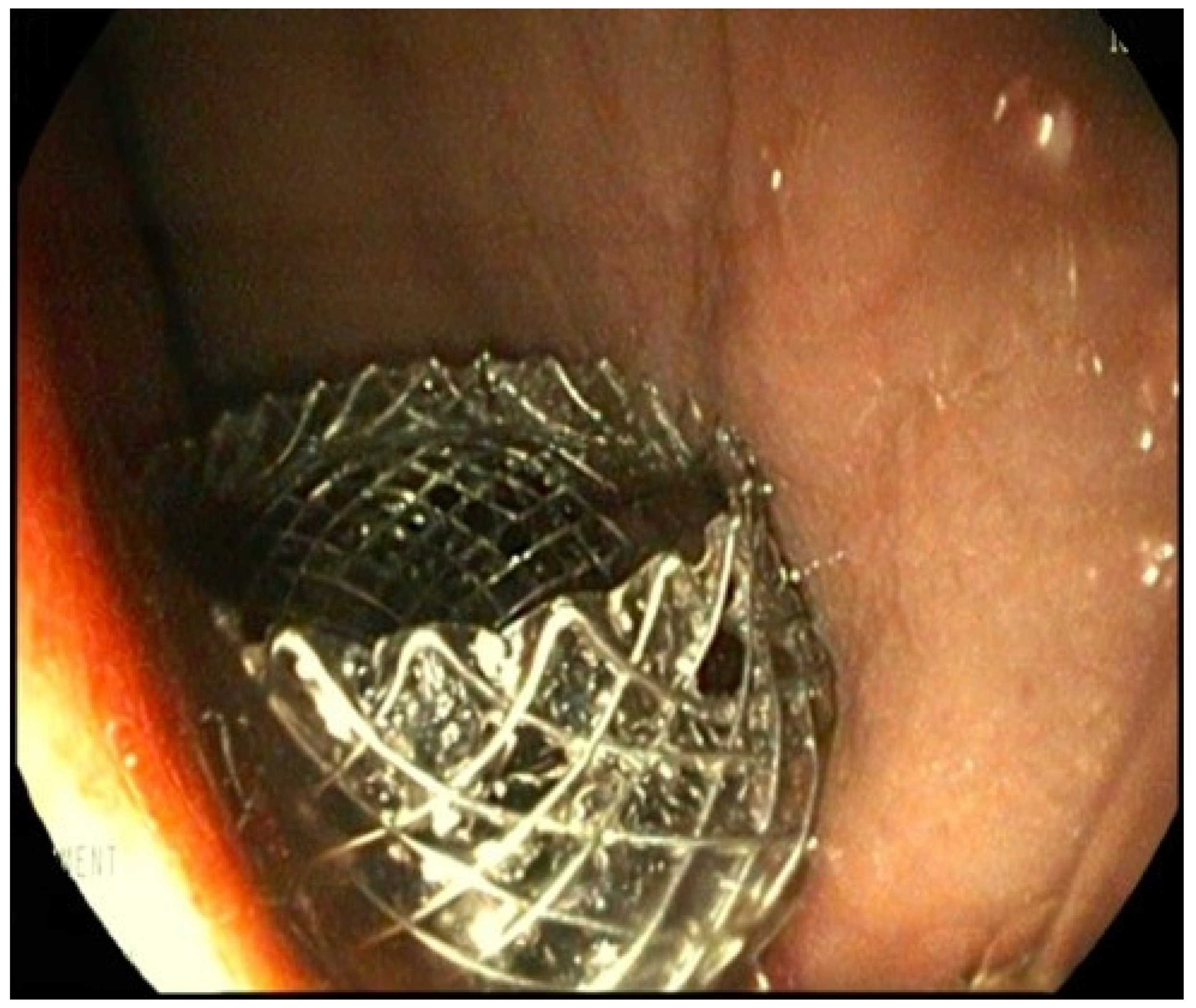 Children 11 00643 g001