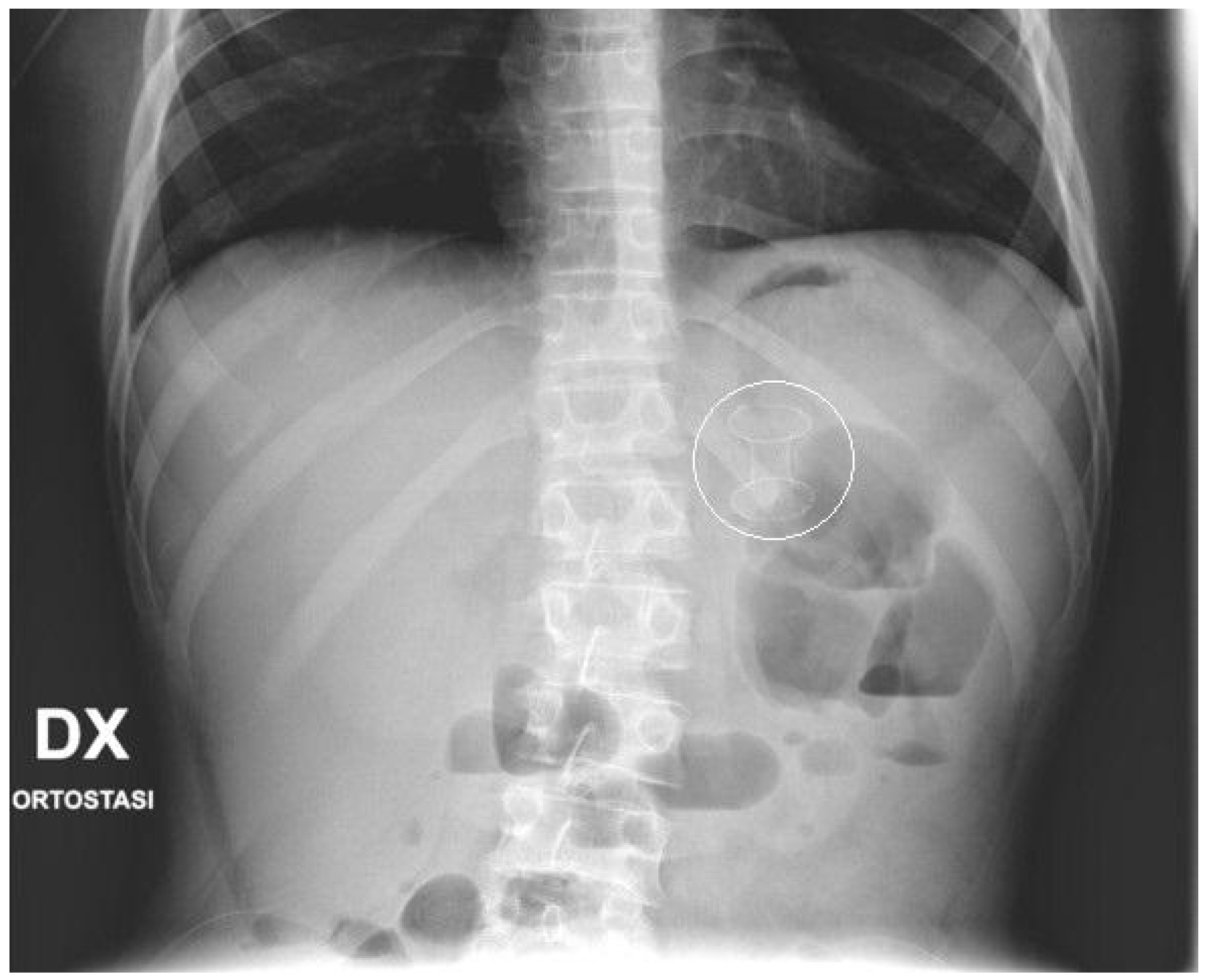 Children 11 00643 g002