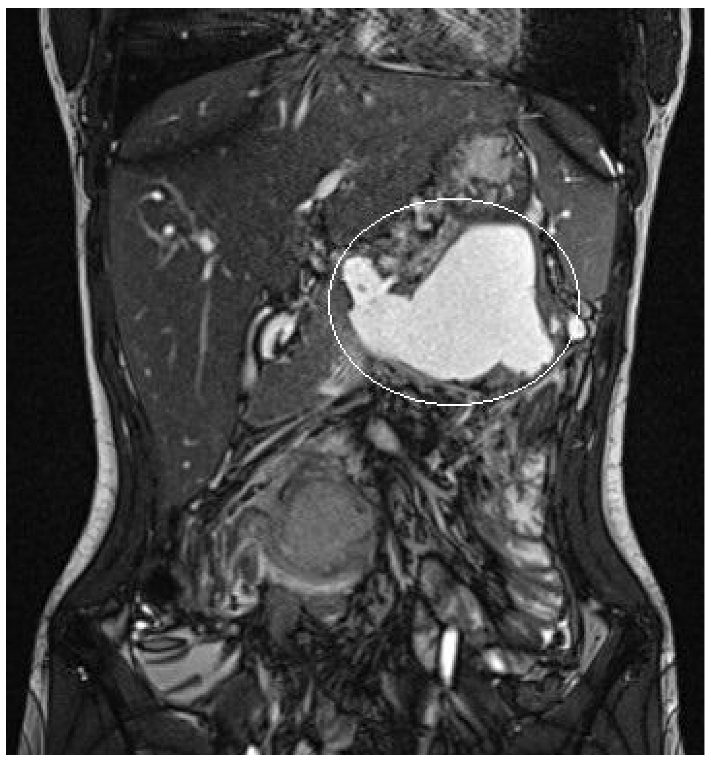 Children 11 00643 g003